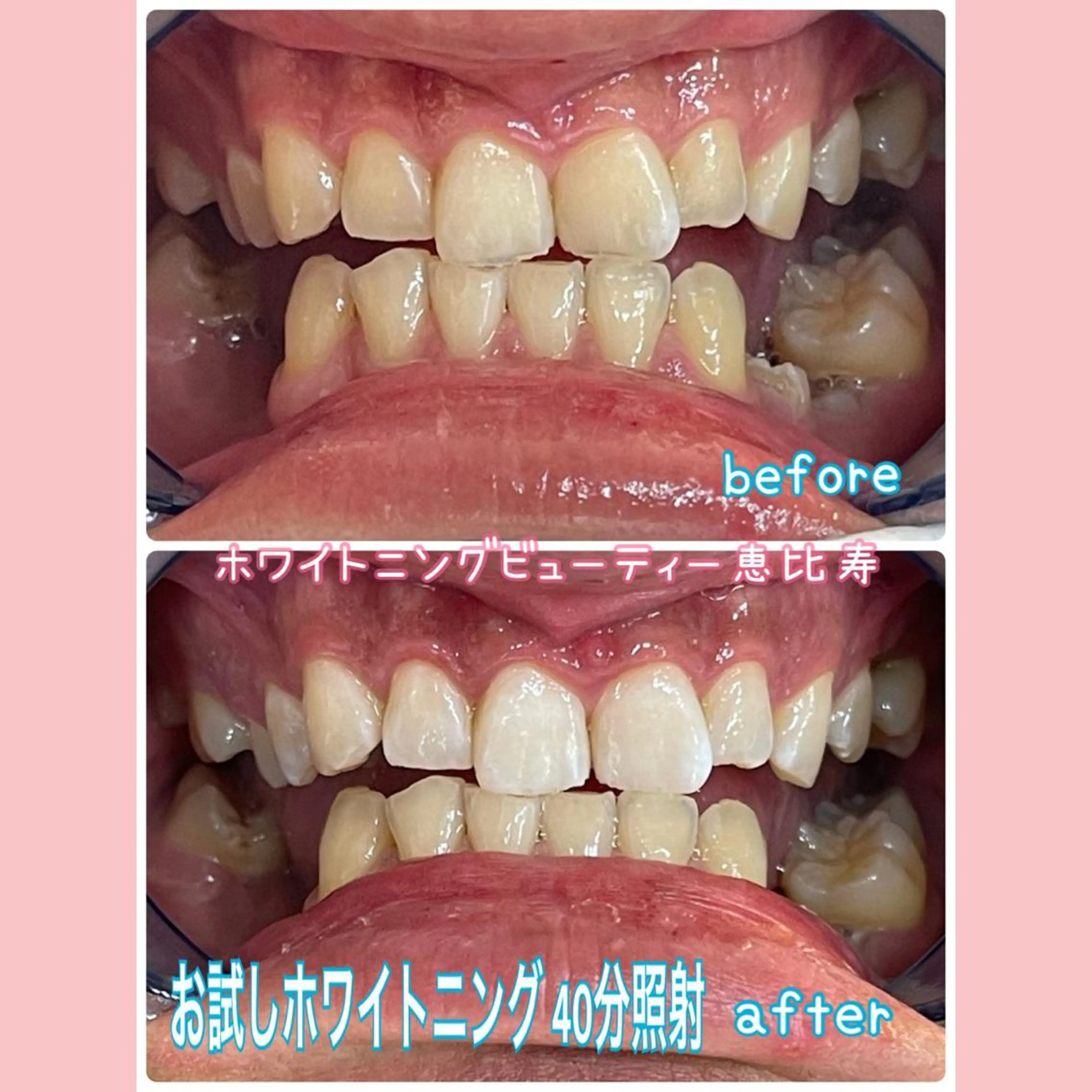 EMINAL恵比寿 HITOMIのエステ・リラクイメージ