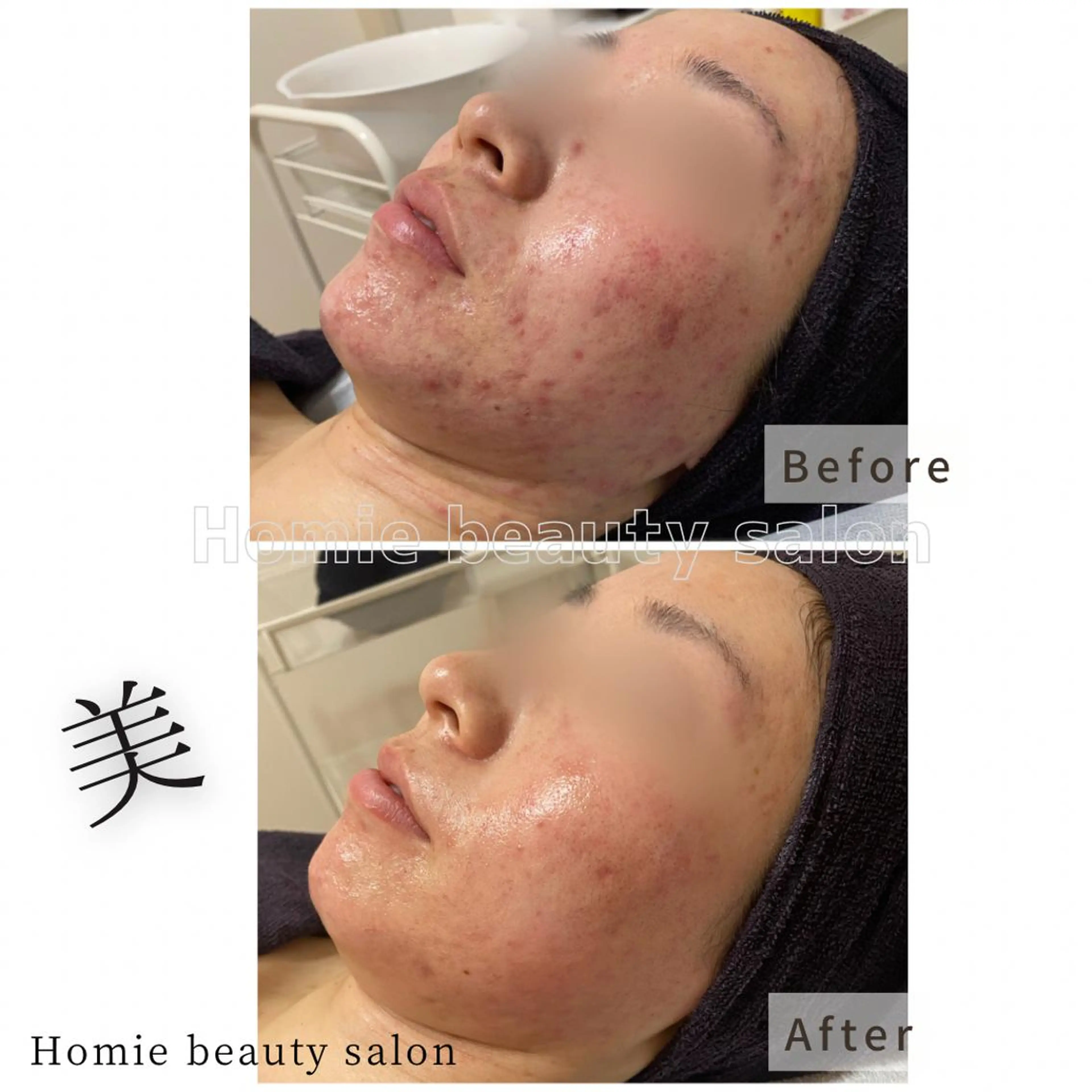 マツエク・マツパ エステ ハーブピーリング🌹 Homieのエステ・リラクイメージ