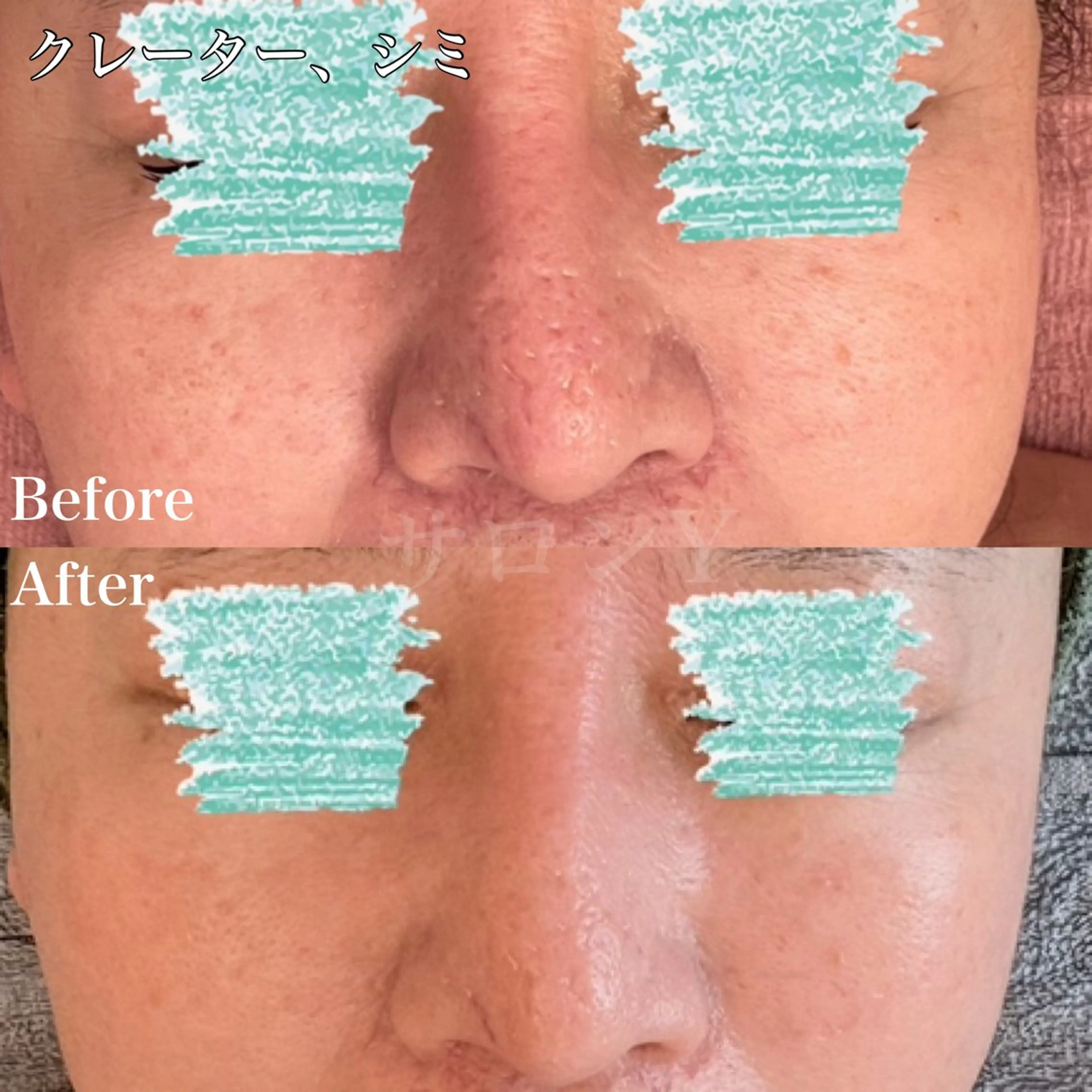 エステ リラク グリーンピール専門店 サロンY【大阪】のエステ・リラクイメージ