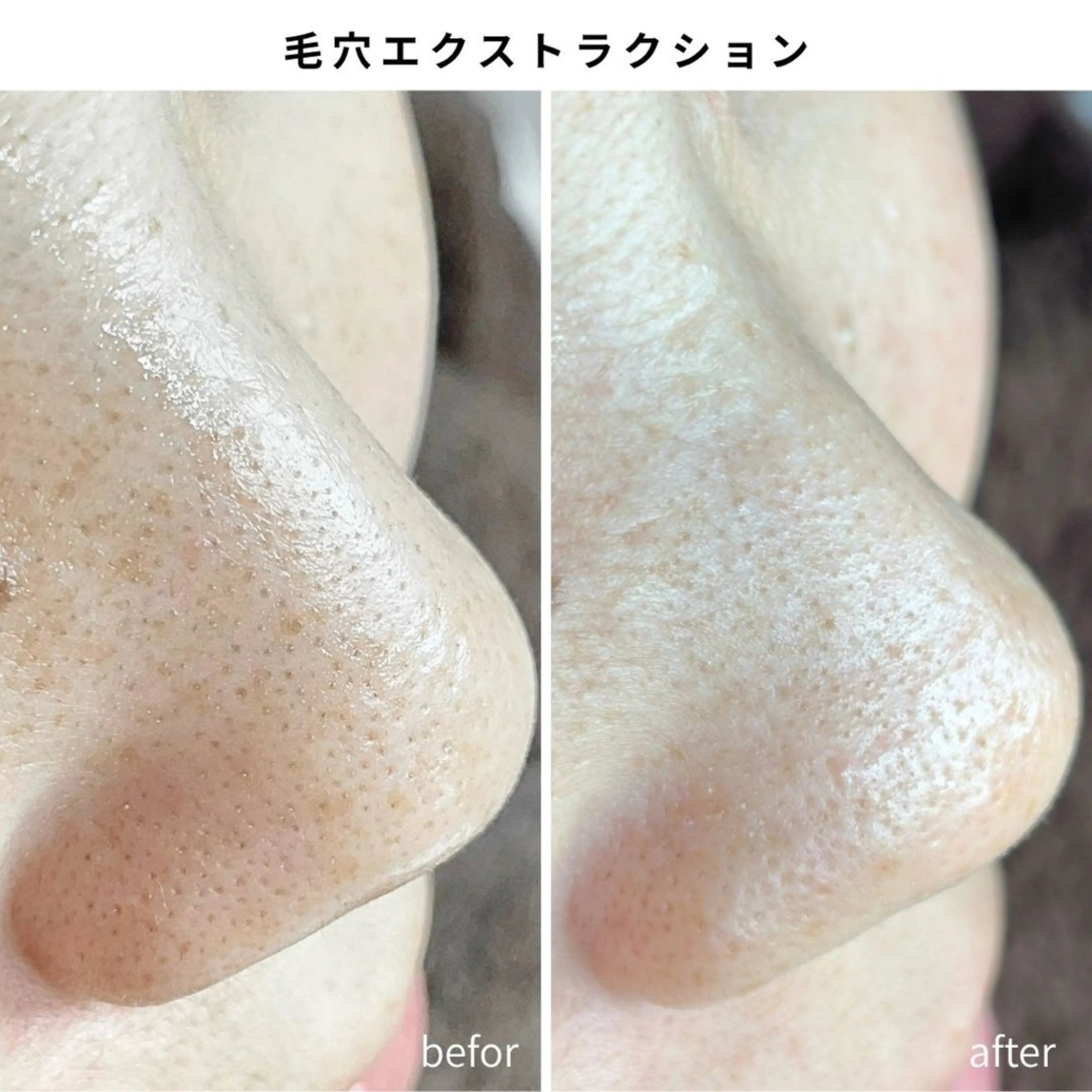 エステ Muqu.所属・Muqu. 毛穴サロンのエステ・リラクイメージ