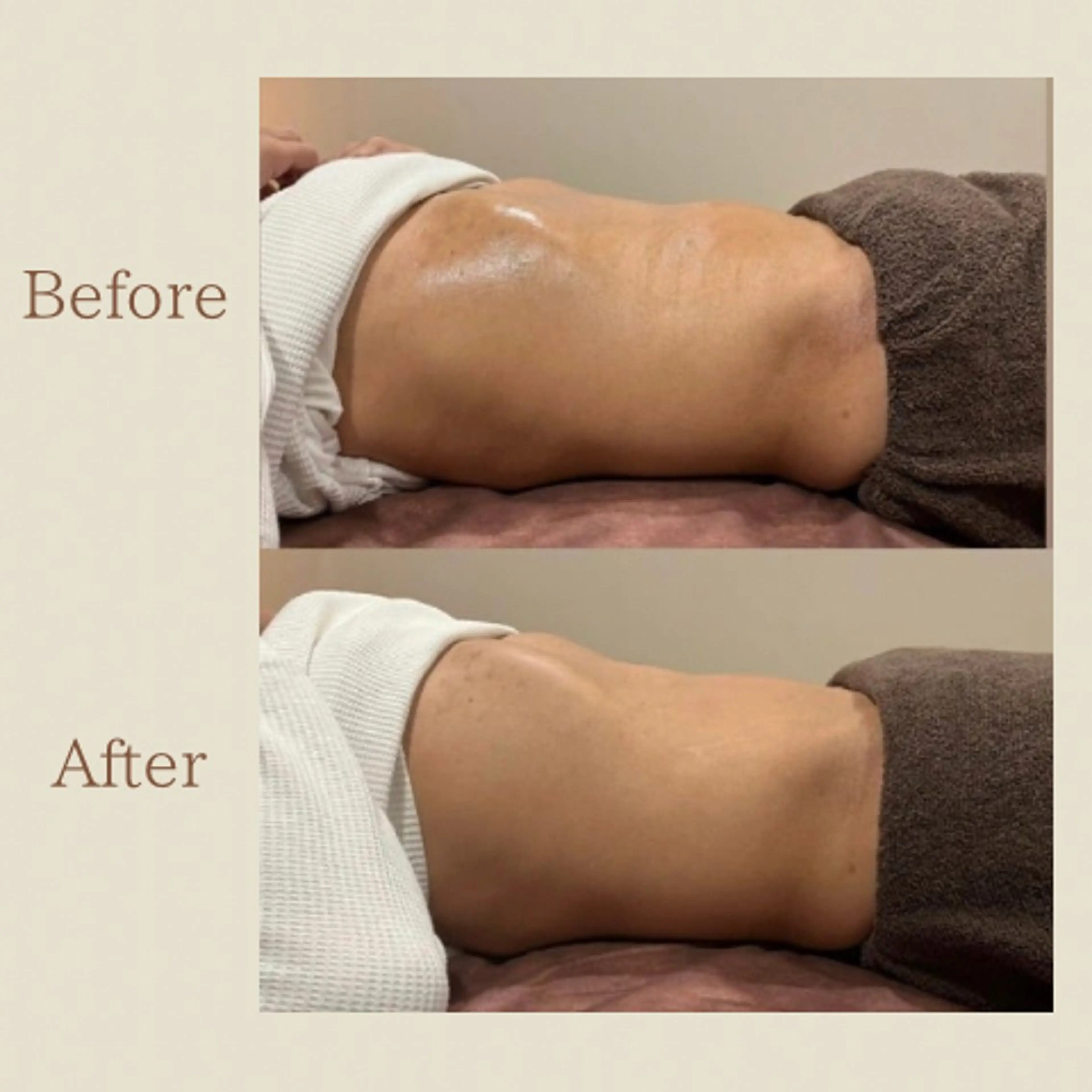 お腹痩せエステ Flat BELLY 恵比寿所属・【腸もみ/冷却痩身】 お腹エステ/恵比寿のエステ・リラクイメージ