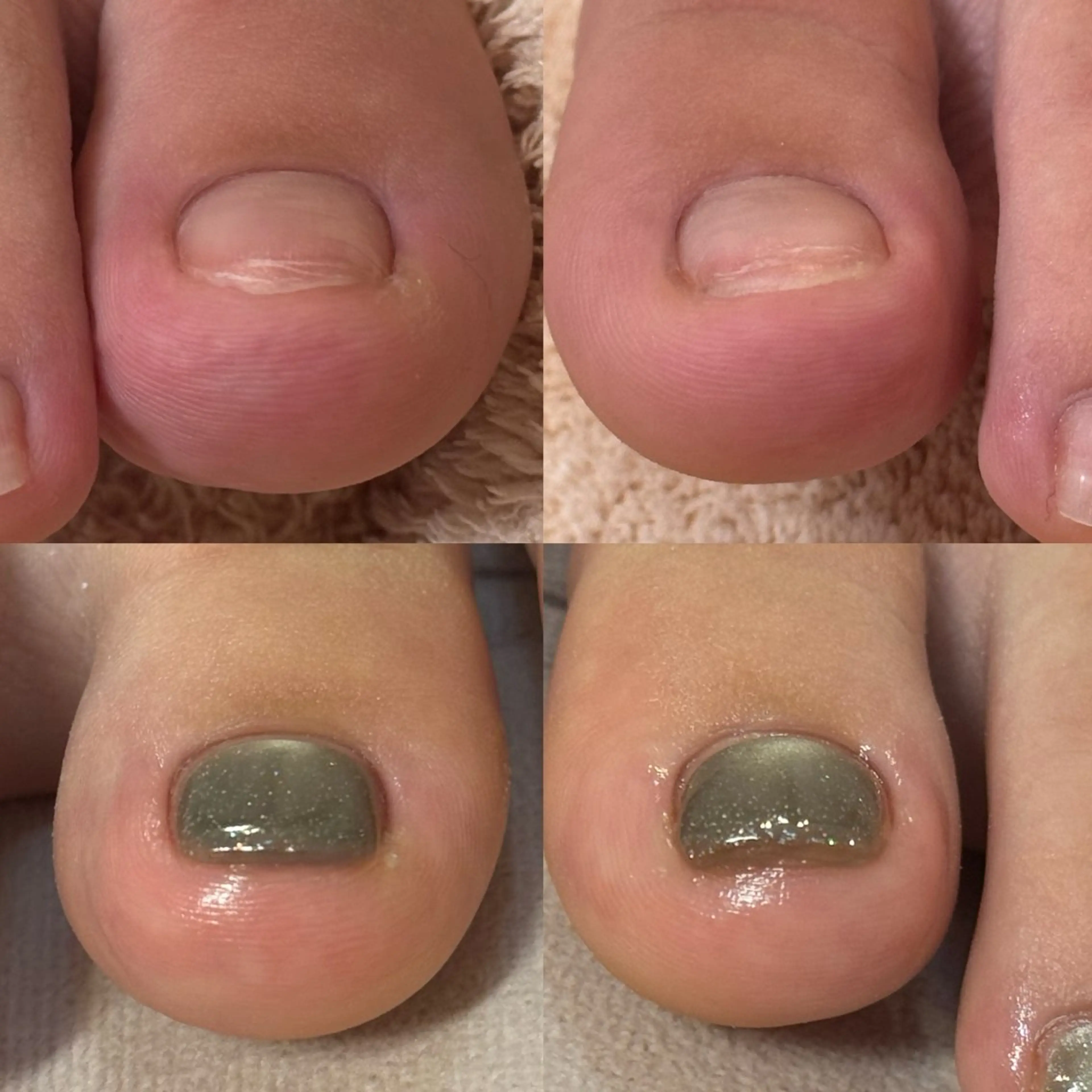 ネイル フットネイル 【enn】Maria Enomotoのネイルデザイン