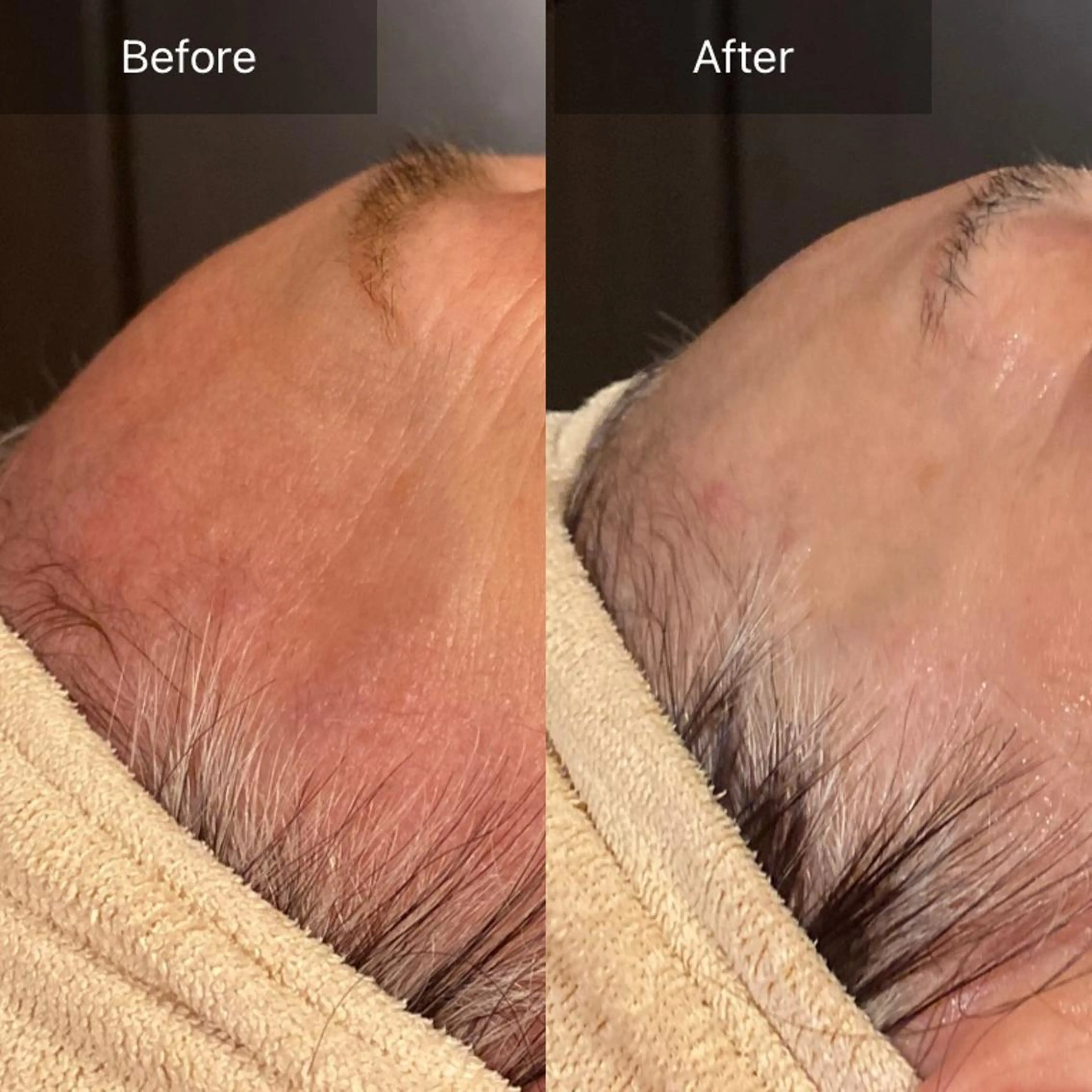 Mandarin Orange所属・毛穴から始める肌メン テマンダリンオレンジのエステ・リラクイメージ