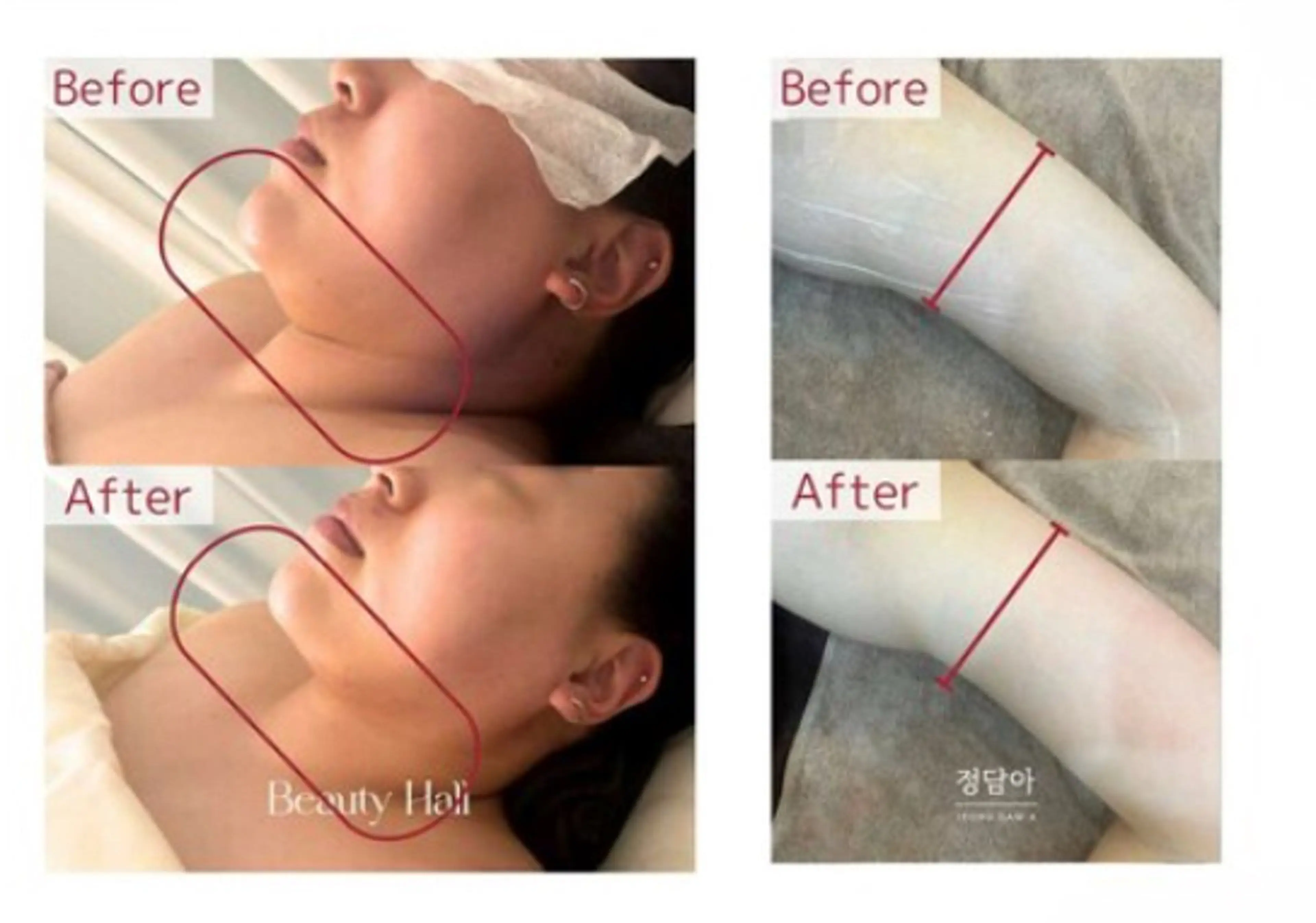 エステ 本気で痩せたい方へ 痩身専門サロンのその他イメージ