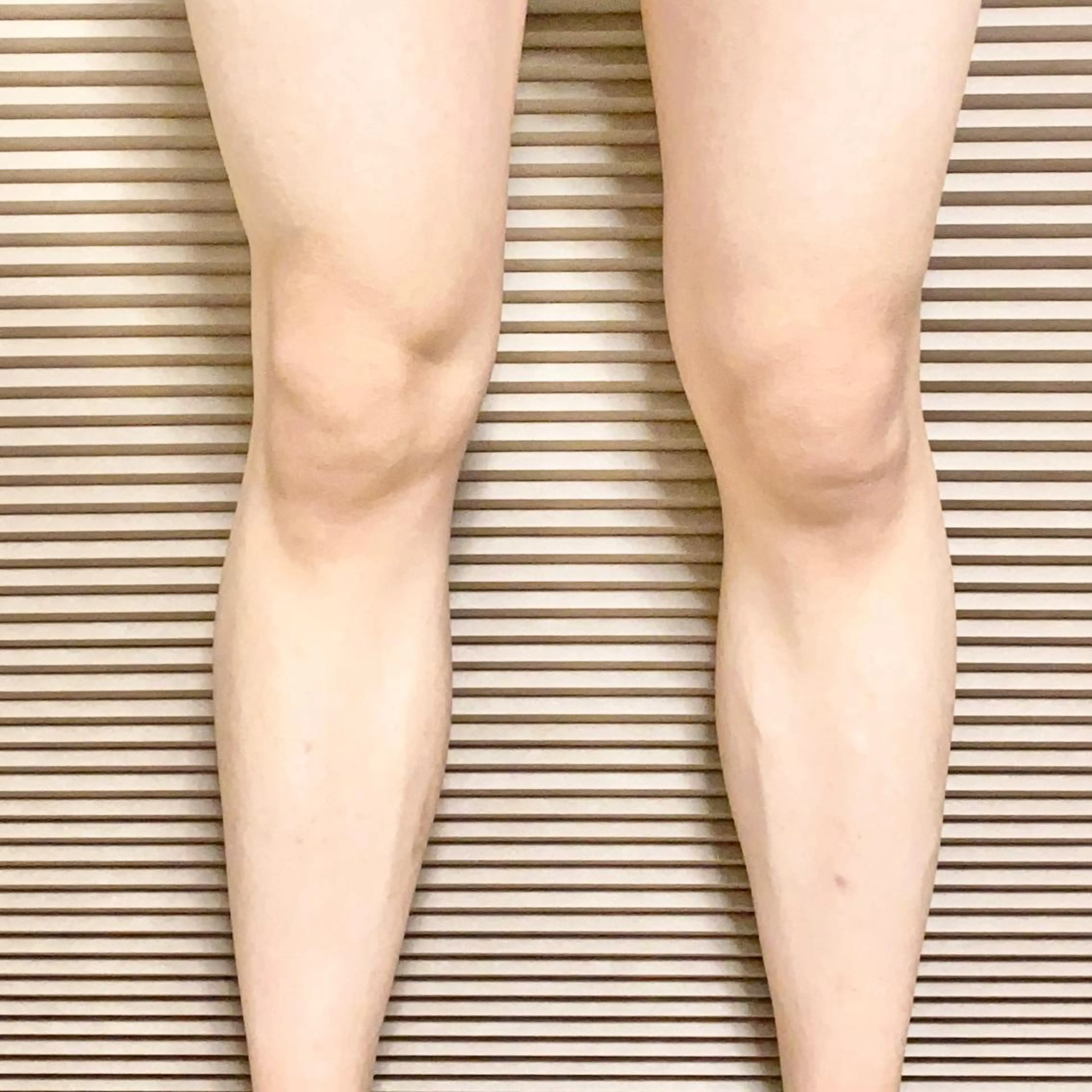 🔹メンズひざ下orひざ上脱毛体験！の写真