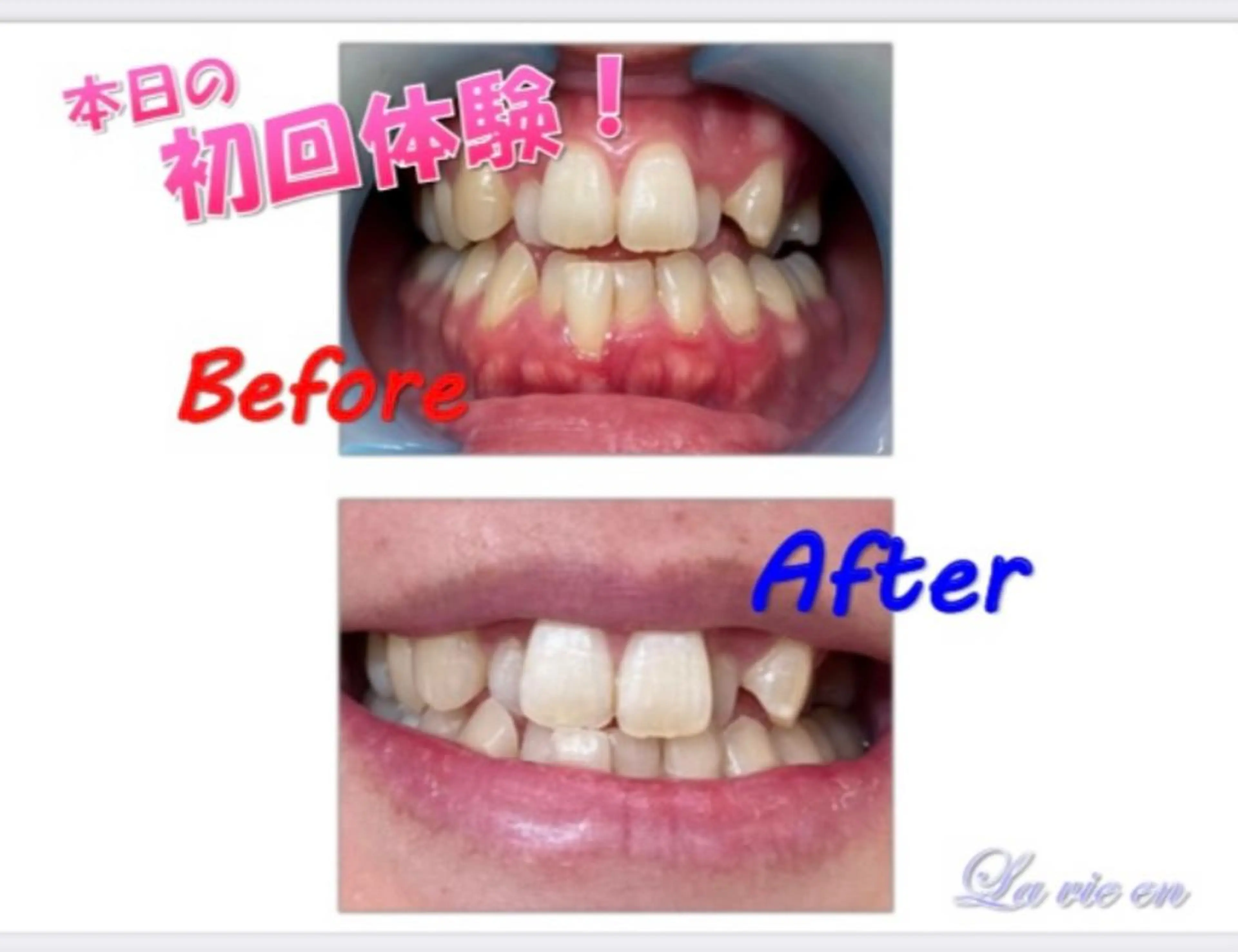 その他 セルフホワイトニングサロン　ラヴィアン所属・ホワイトニングサロン La vie enのその他イメージ