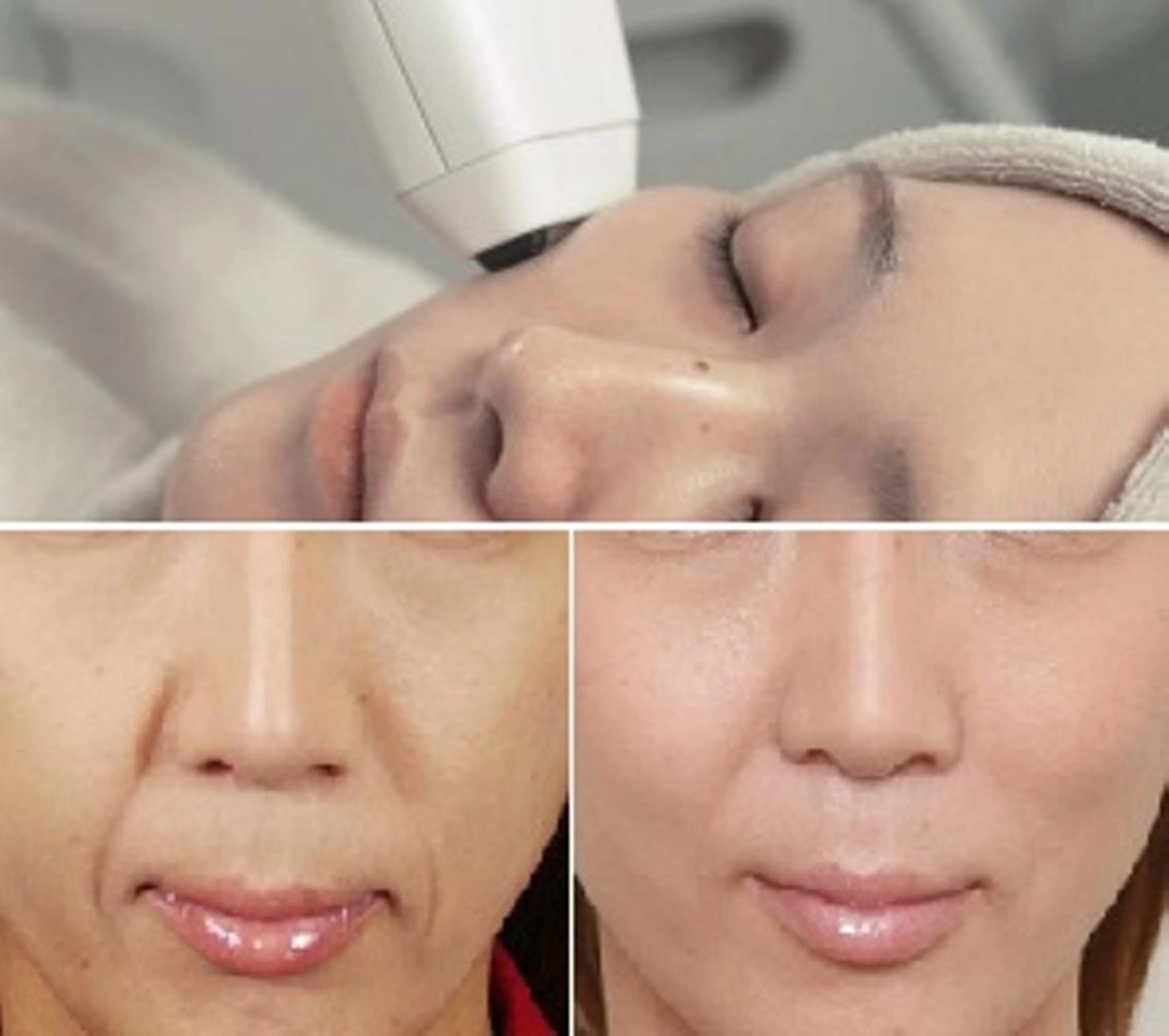 エステ 顔脱毛＆毛穴＆ニキビ 優良№1♪ヒロコ♪のエステ・リラクイメージ