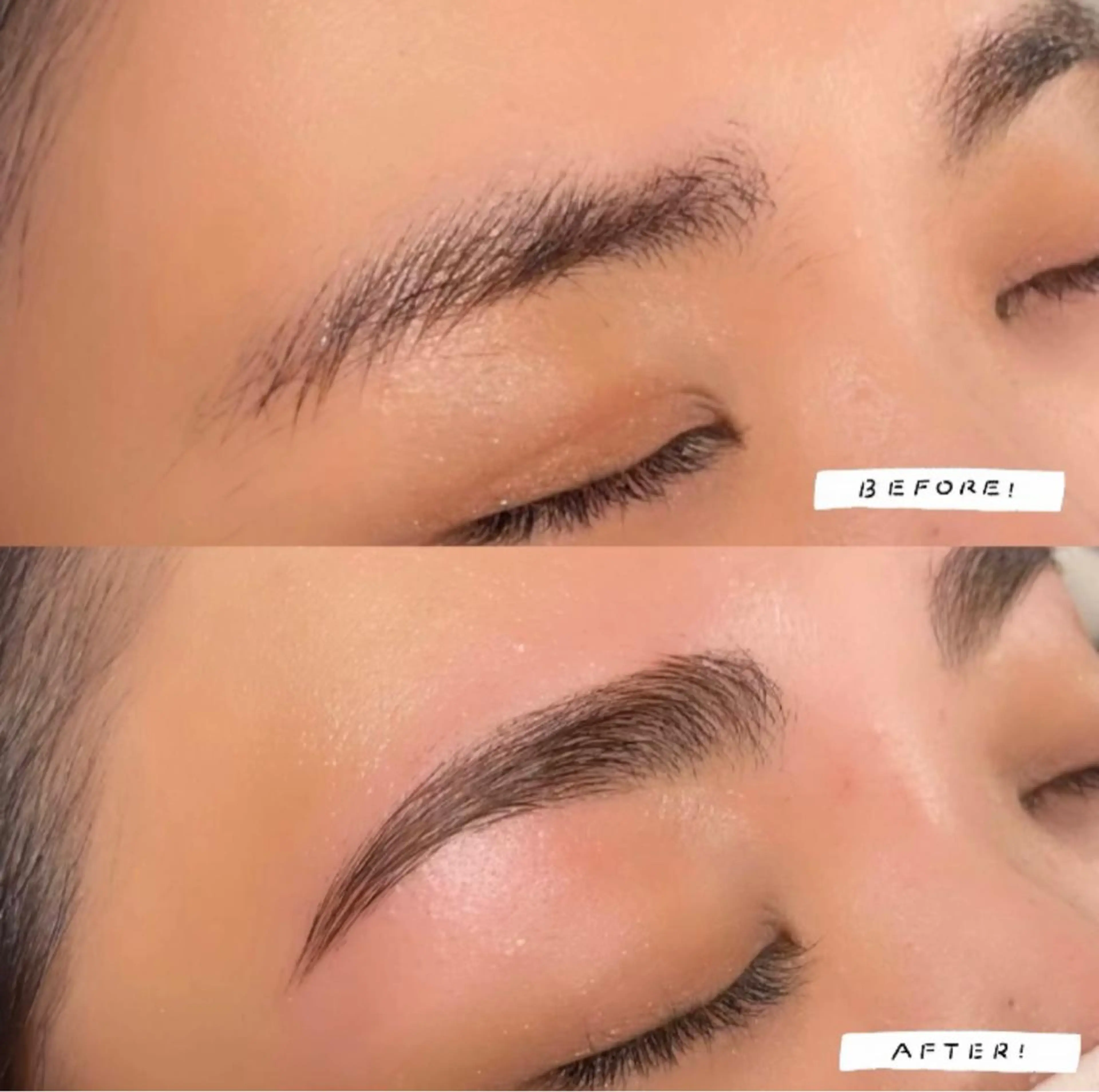 ハリウッドブロウリフト&脱毛sパーツ付きの写真