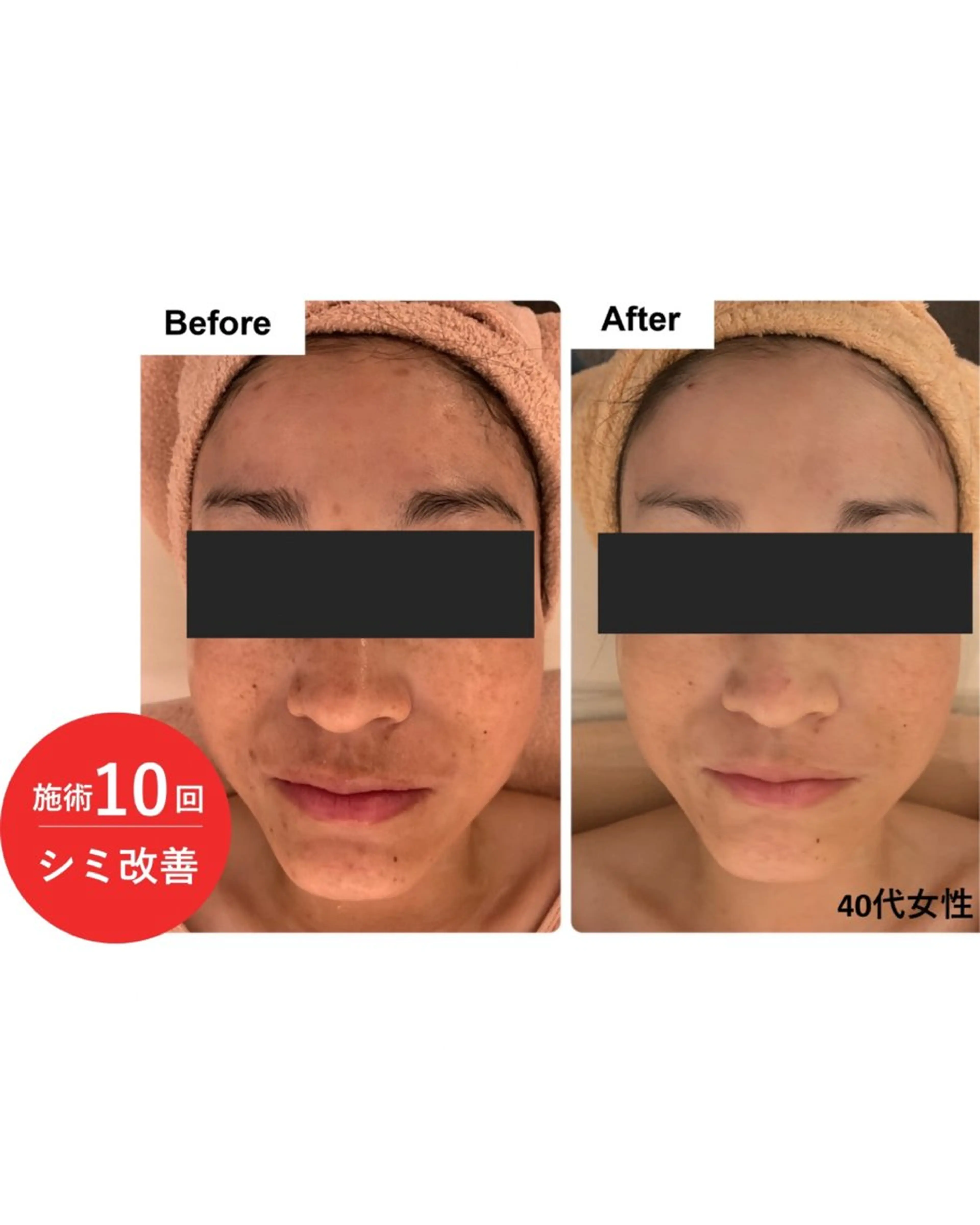 エステ シミ・若返り特化 さゆみのエステ・リラクイメージ