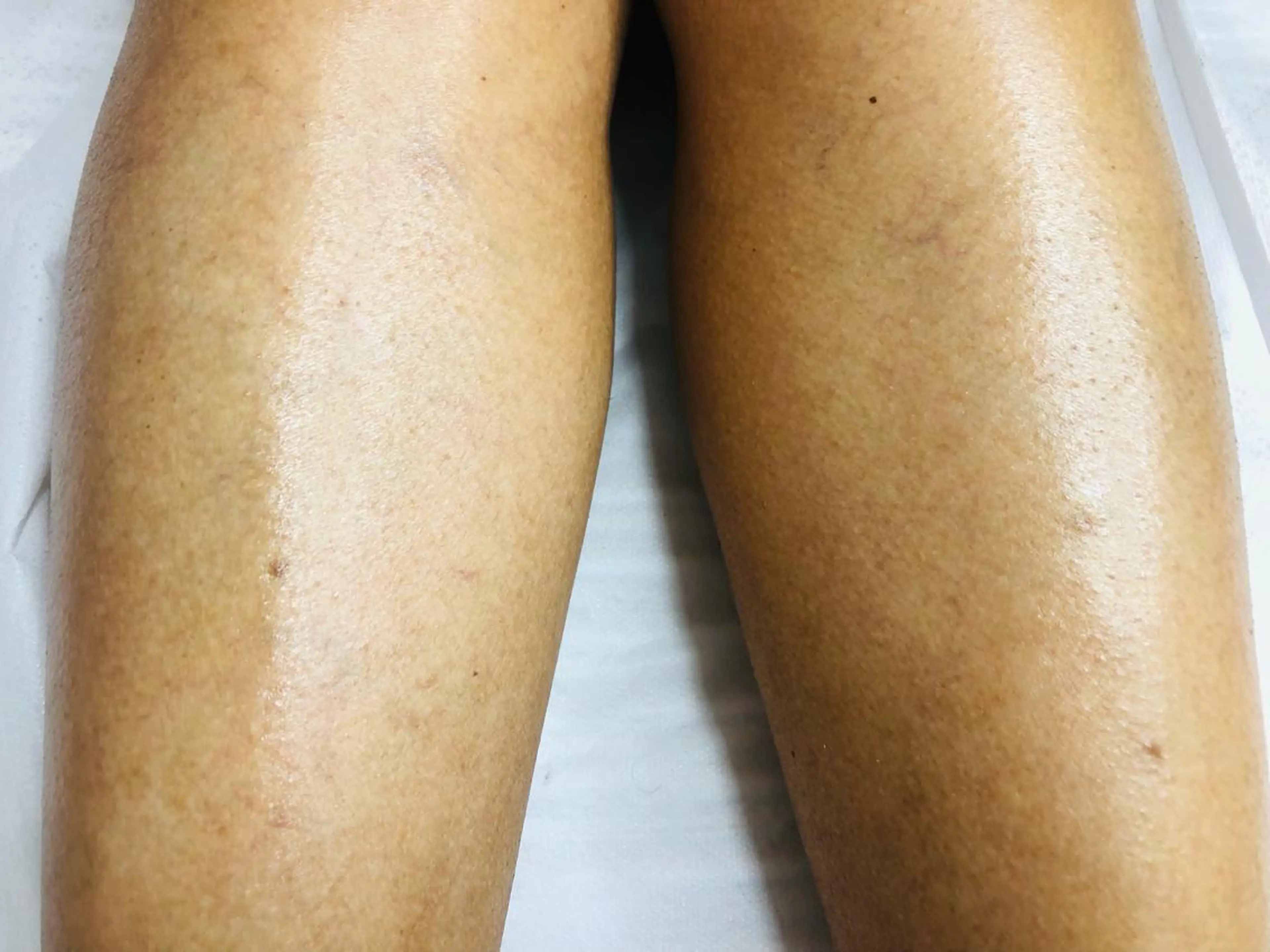 ブラジリアンワックス グレイスのエステ・リラクイメージ