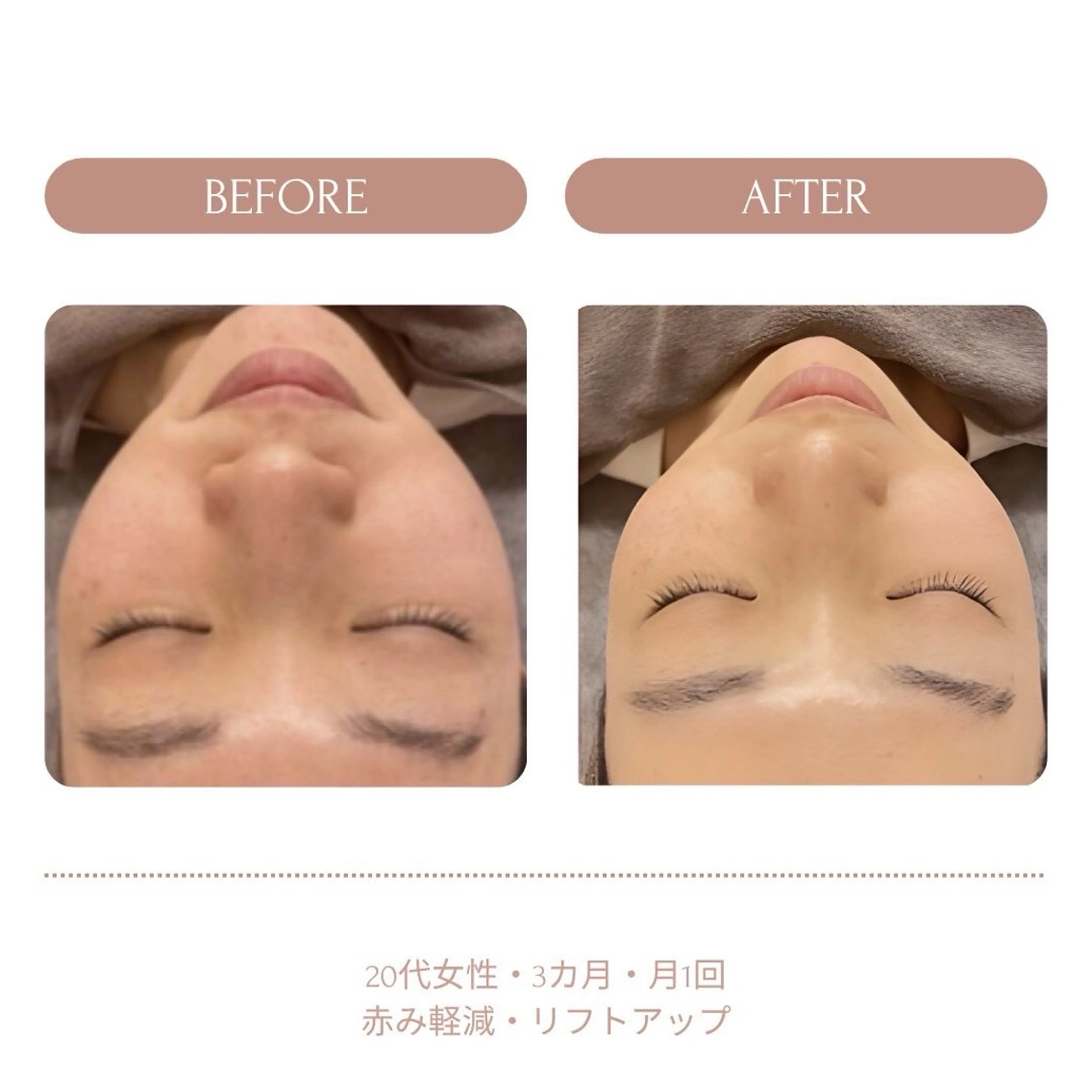 脱毛　Beauty salon Lumiere（ルミエール）所属・完全都度払い脱毛⭐︎ Lumiereのエステ・リラクイメージ