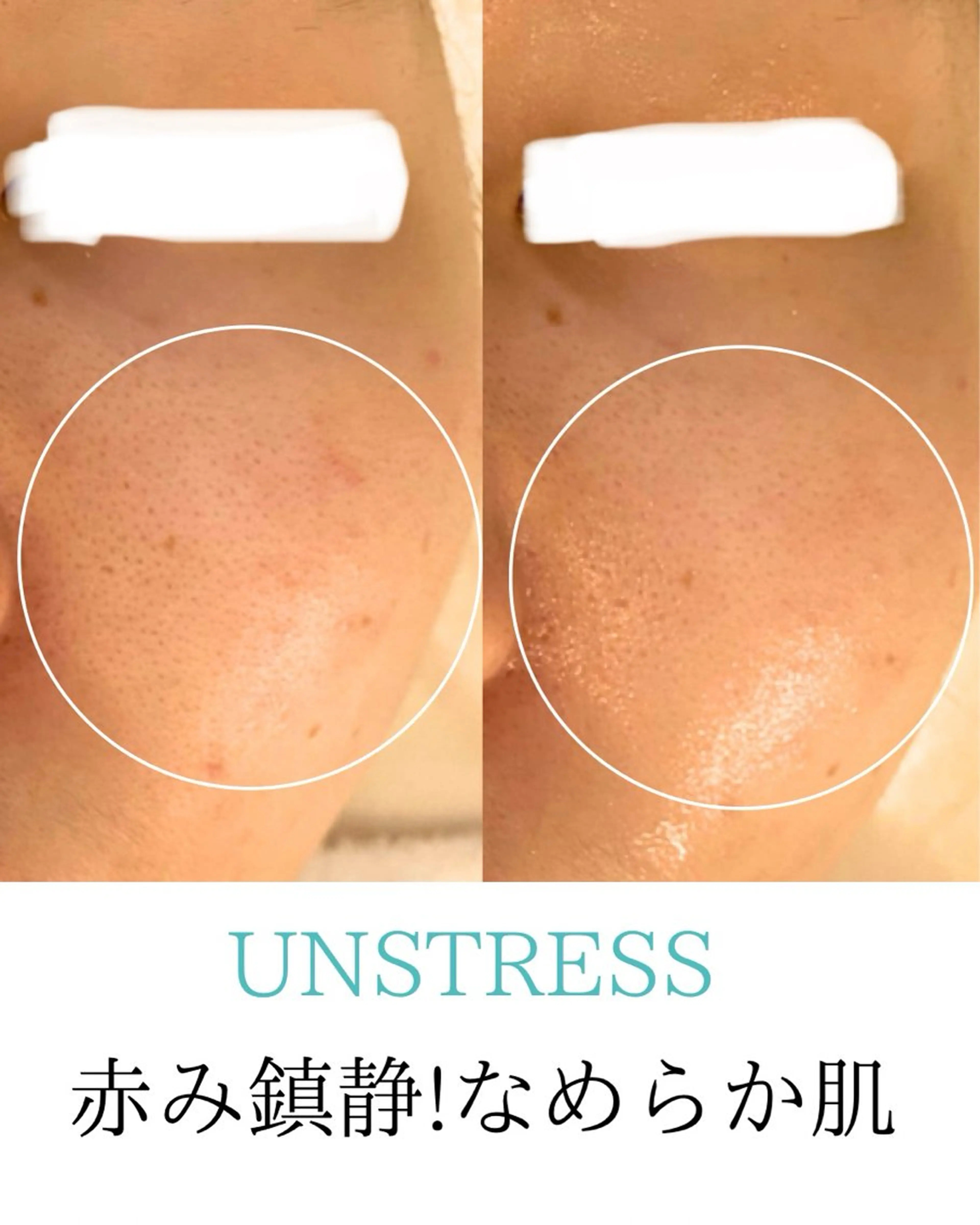 エステ リラク 田中For..天王寺 肌質改善/よもぎ蒸しのエステ・リラクイメージ