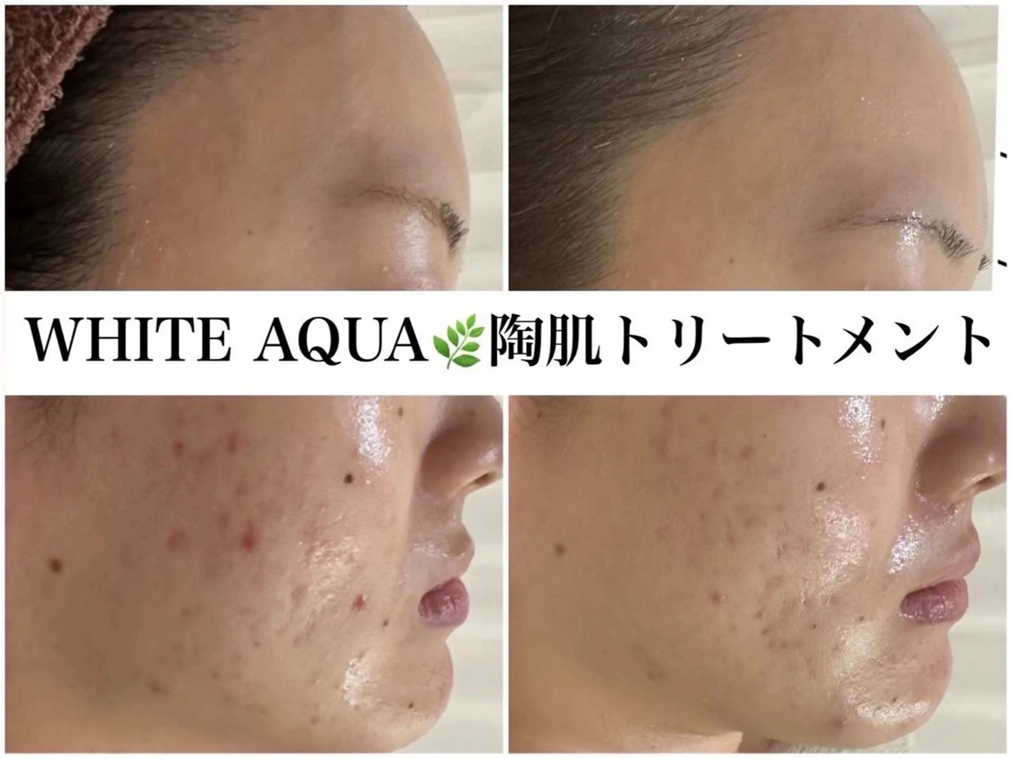 ハーブピーリング/ ララピール専門店のエステ・リラクイメージ