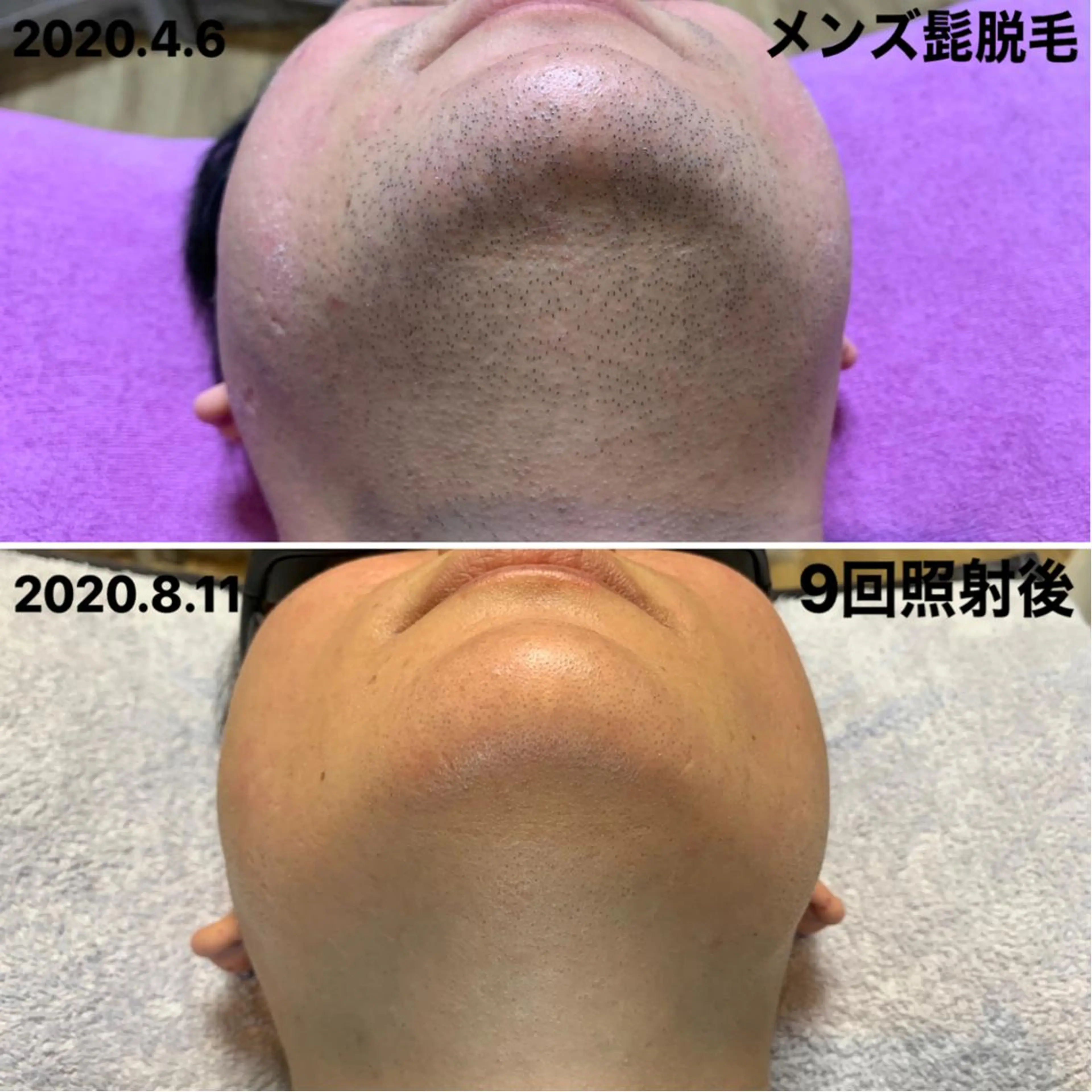 メンズ 脱毛＆エステサロン【アンリミット】所属・森谷 莉美のエステ・リラクイメージ