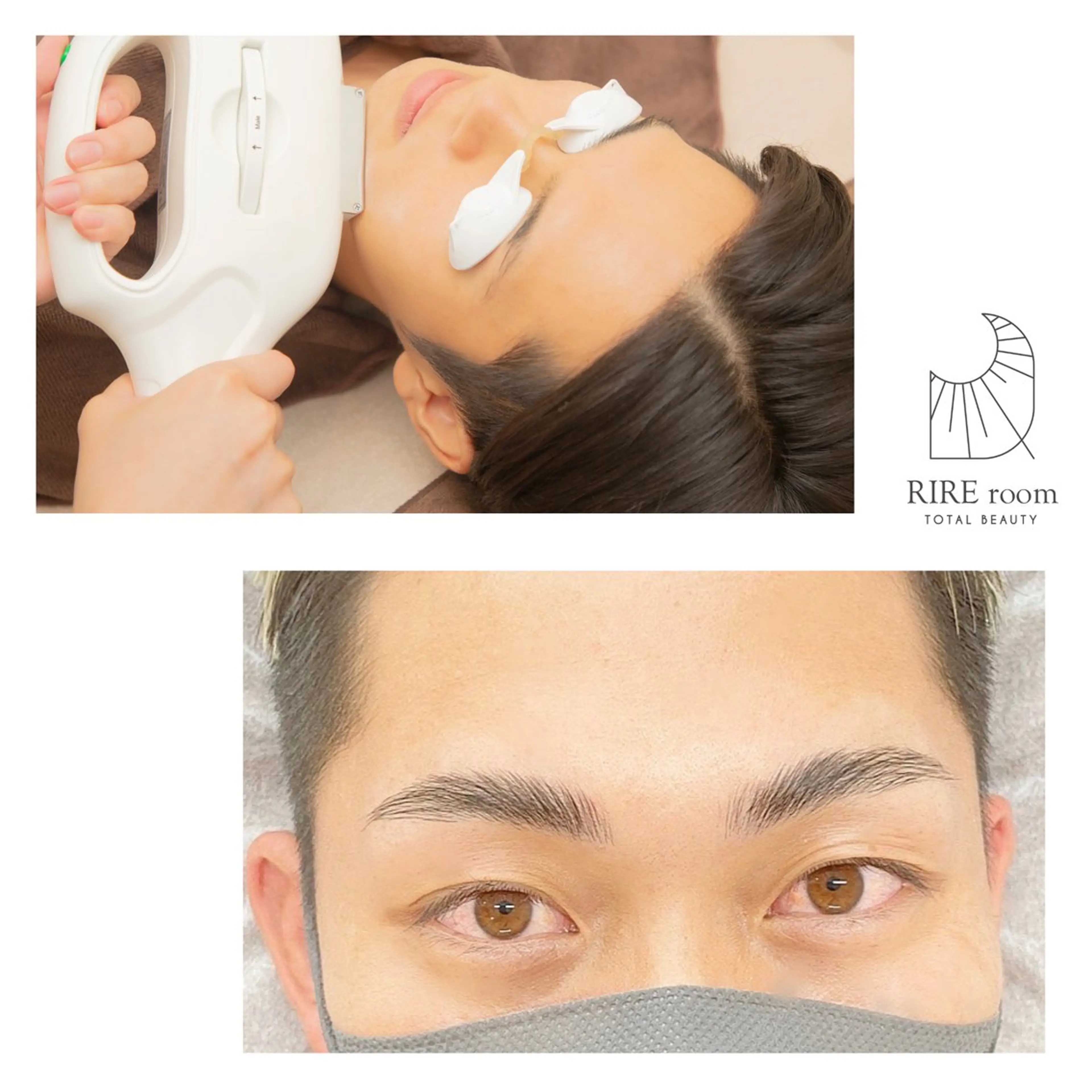 【人気セット】お顔脱毛×メンズハリウッドブロウリフト ¥11500の写真