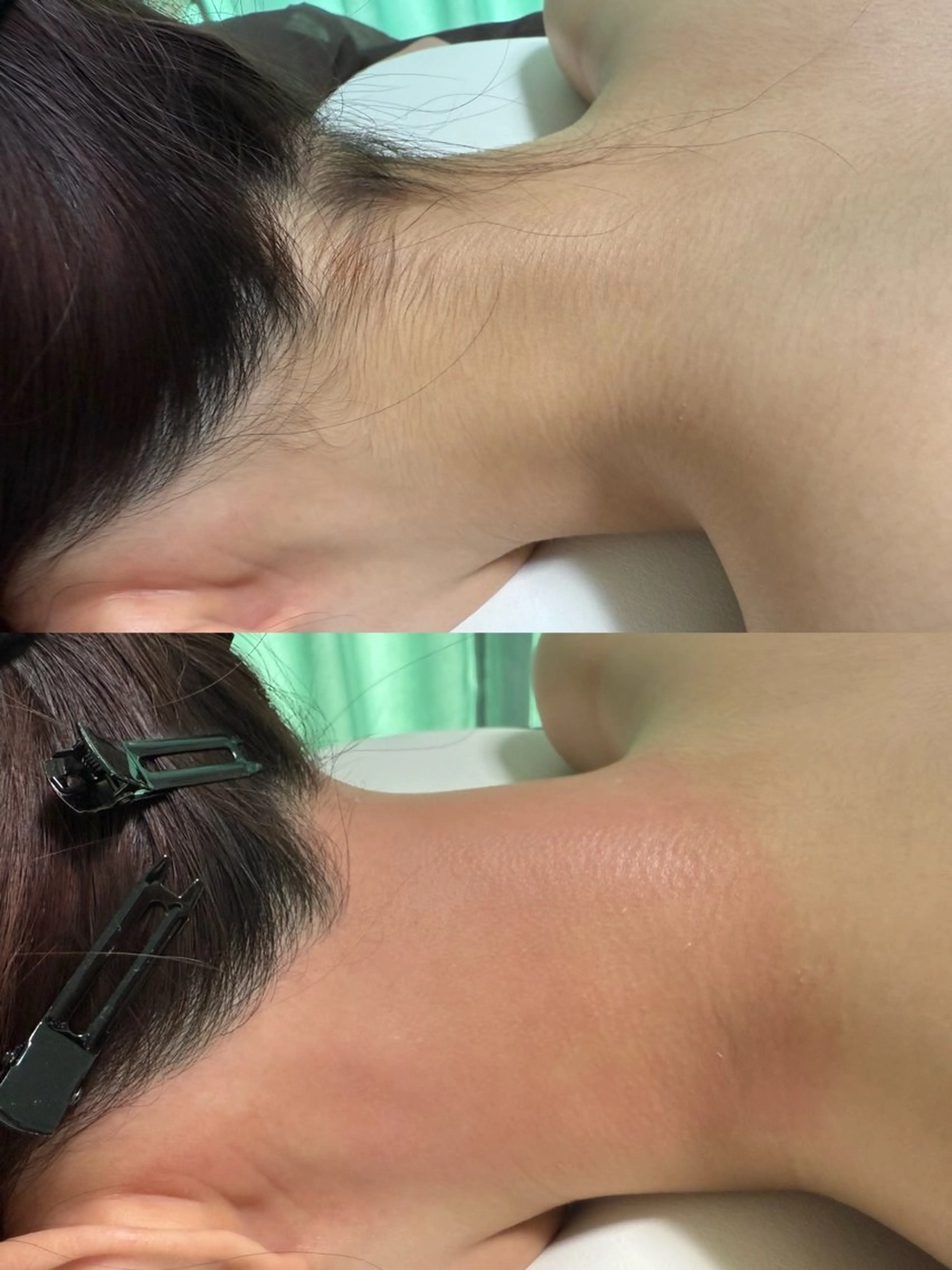 フェイシャルパールワックス＋襟足ワックスの写真