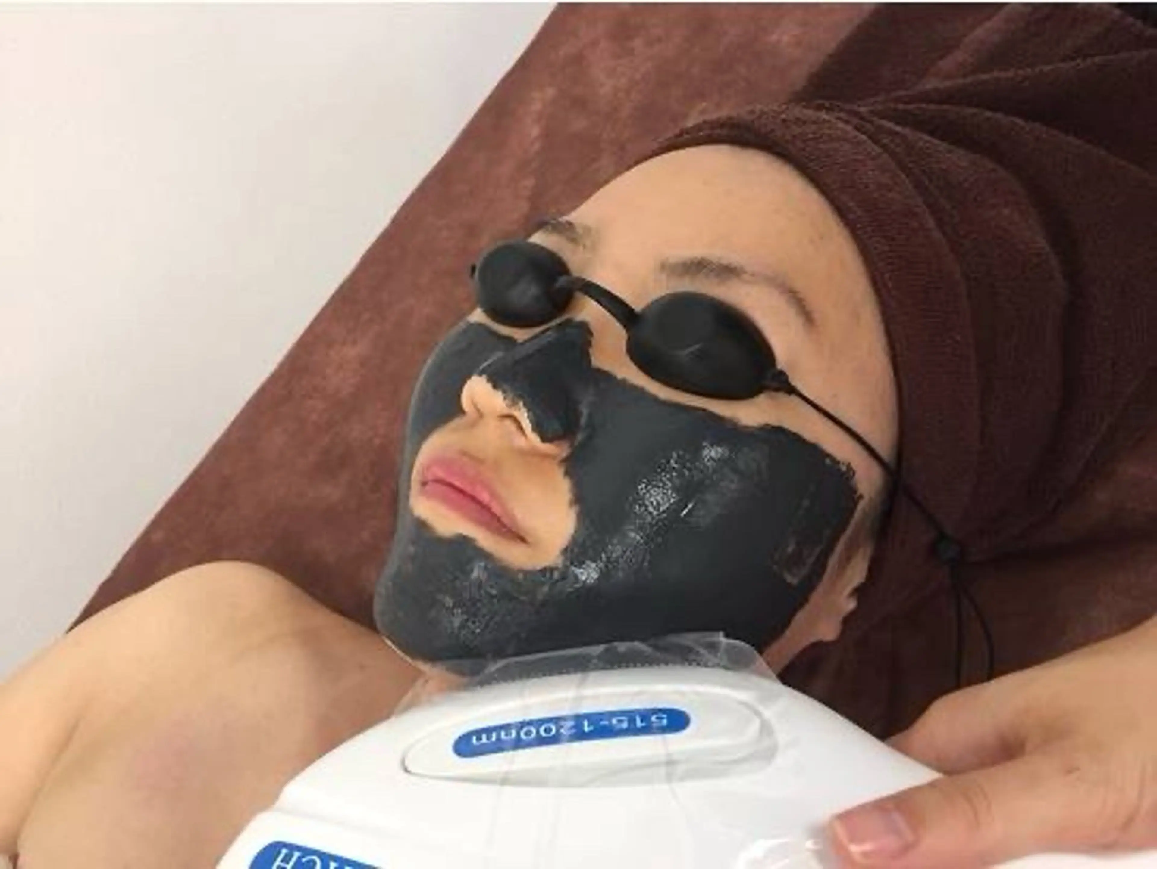 【初回体験】アクネ菌撃退ニキビケア！ブラックピーリングの写真