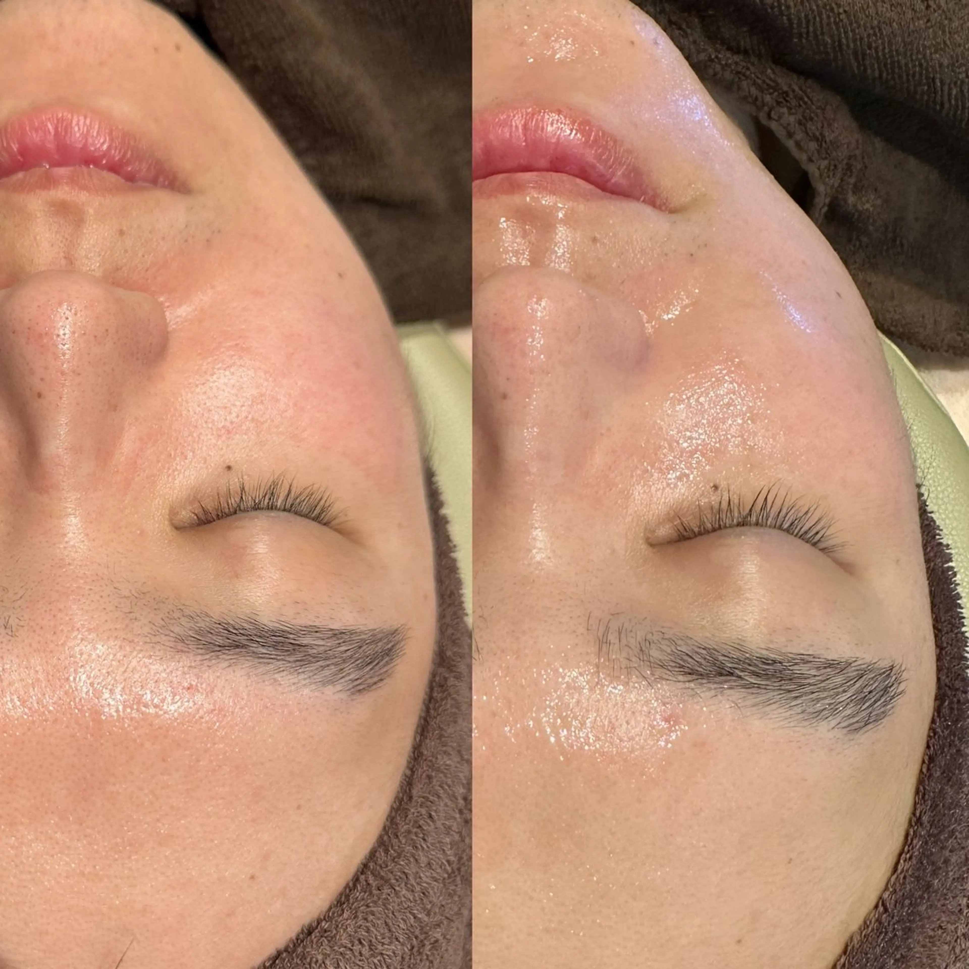 エステ 毛穴専門店Bebe 蘭のエステ・リラクイメージ