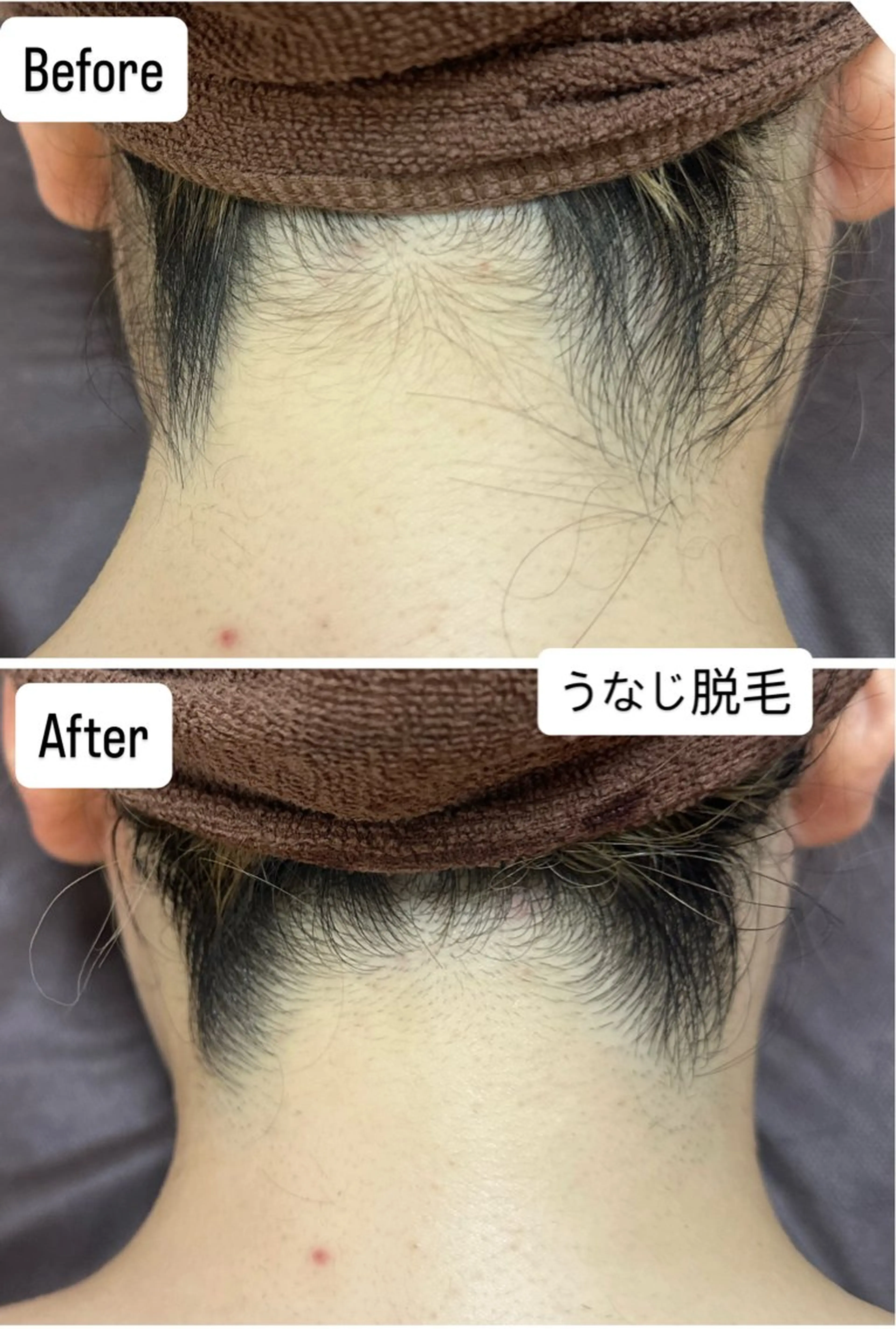 脱毛 桐山 まどかのエステ・リラクイメージ