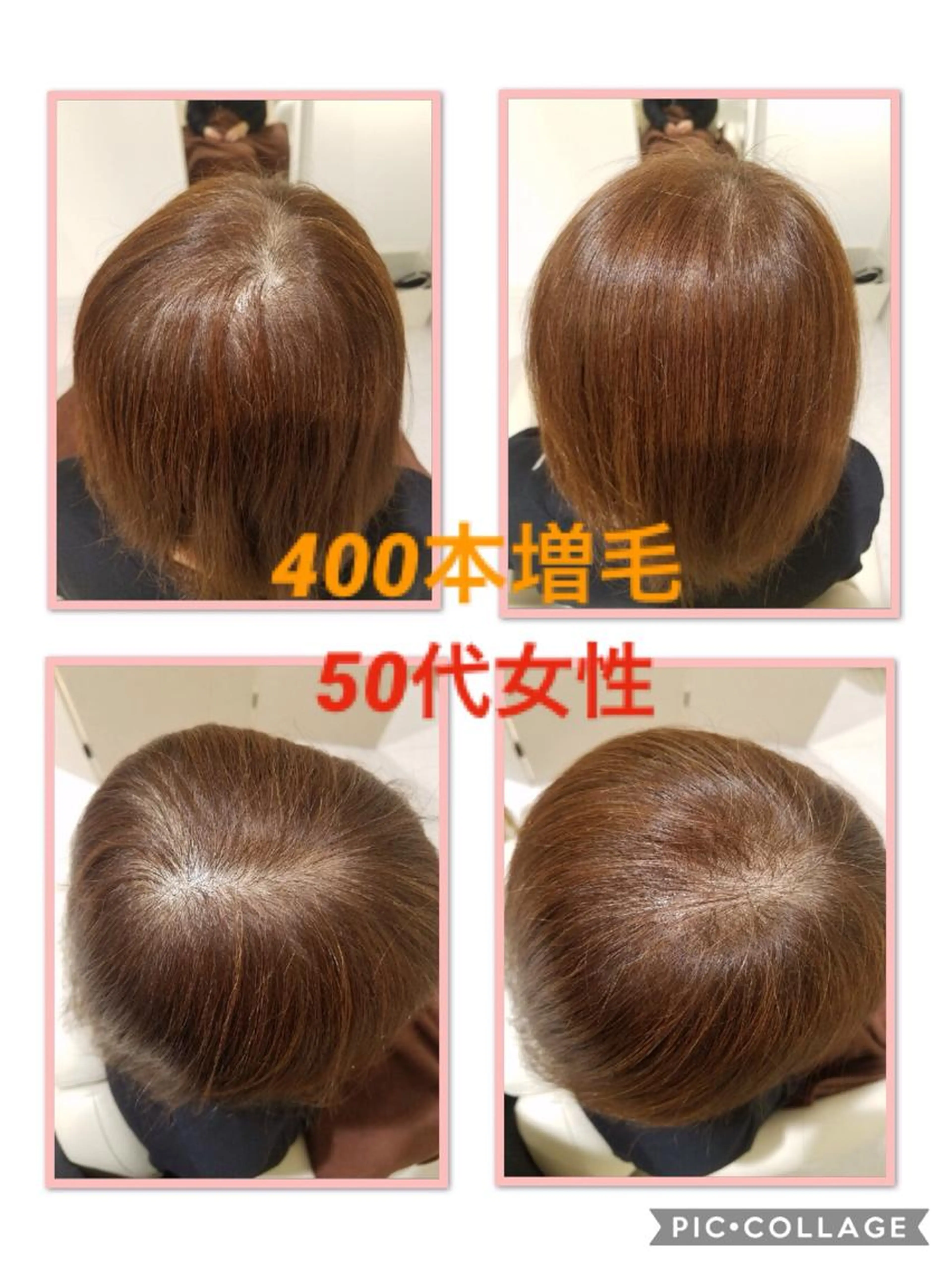 増毛エクステ400本の写真