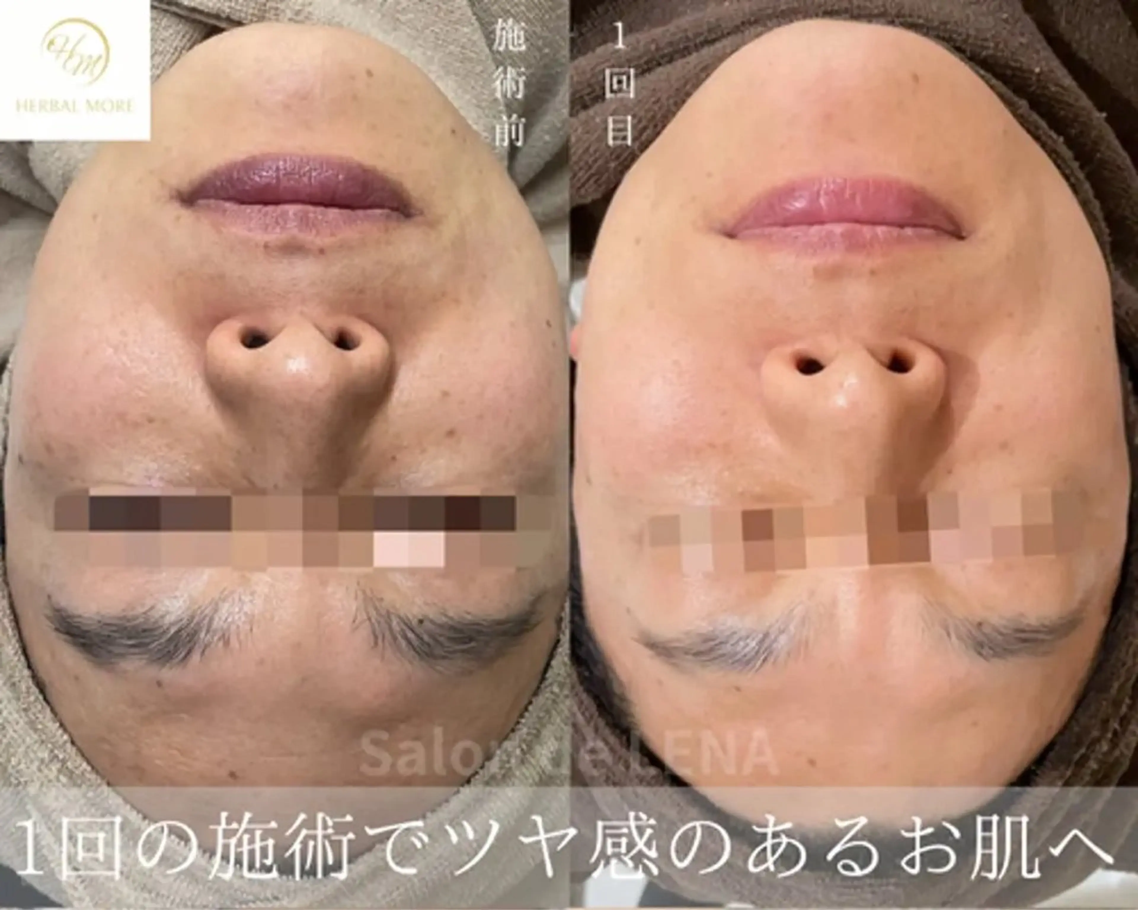 Grandir所属・ハーブピーリング専門 グランディール　武内のエステ・リラクイメージ