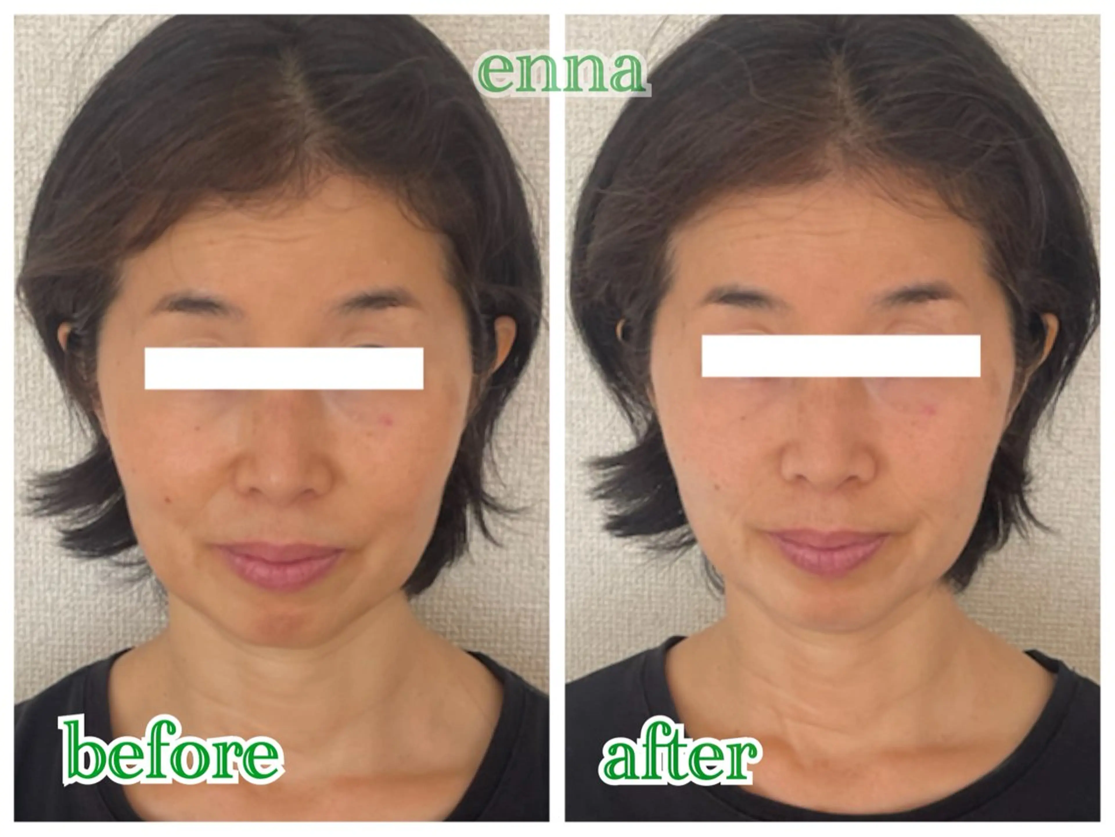 三上 笑里奈のエステ・リラクイメージ