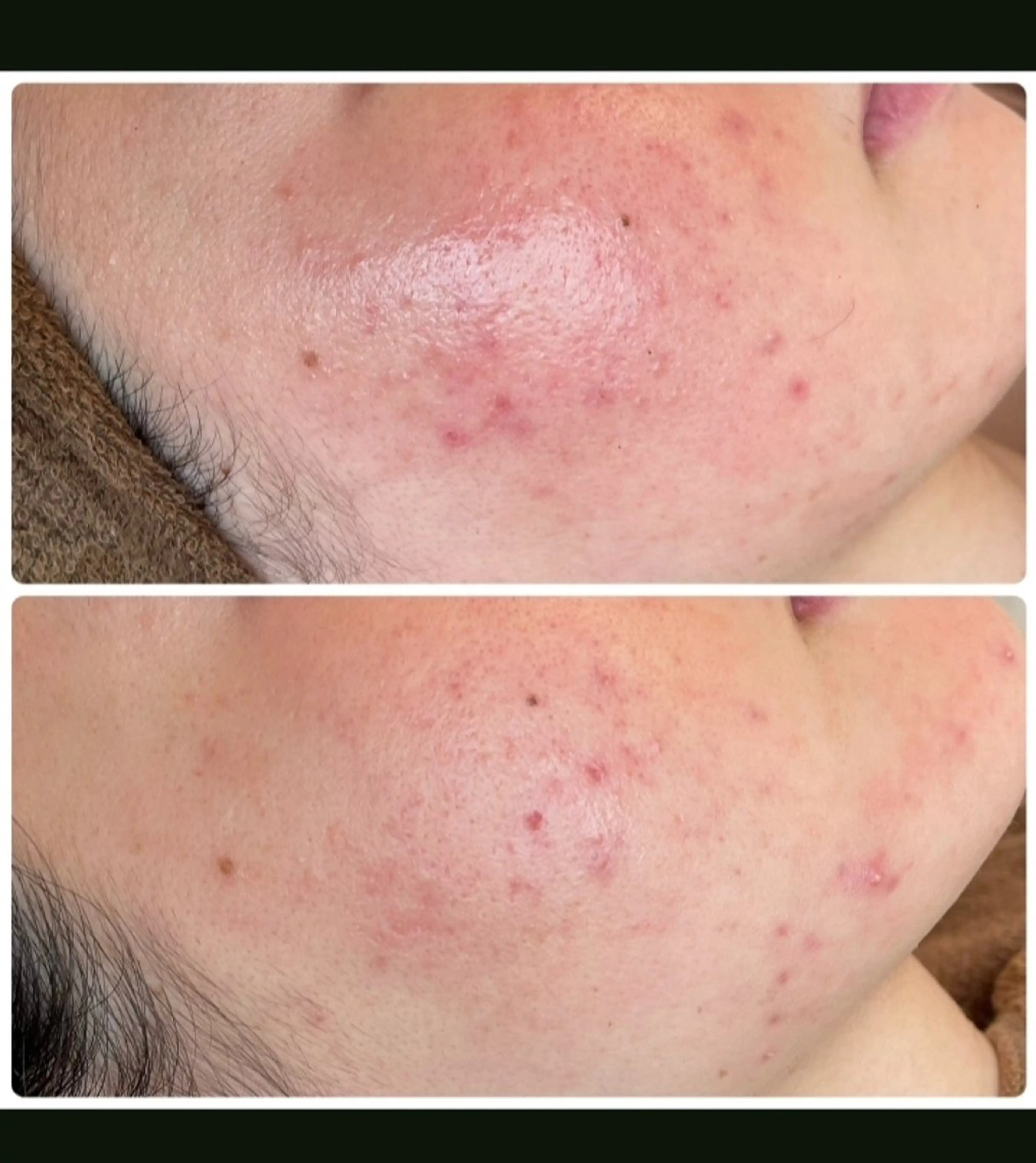 月のあかり所属・オイル＆フェイシャル 【月のあかり🌙】のエステ・リラクイメージ