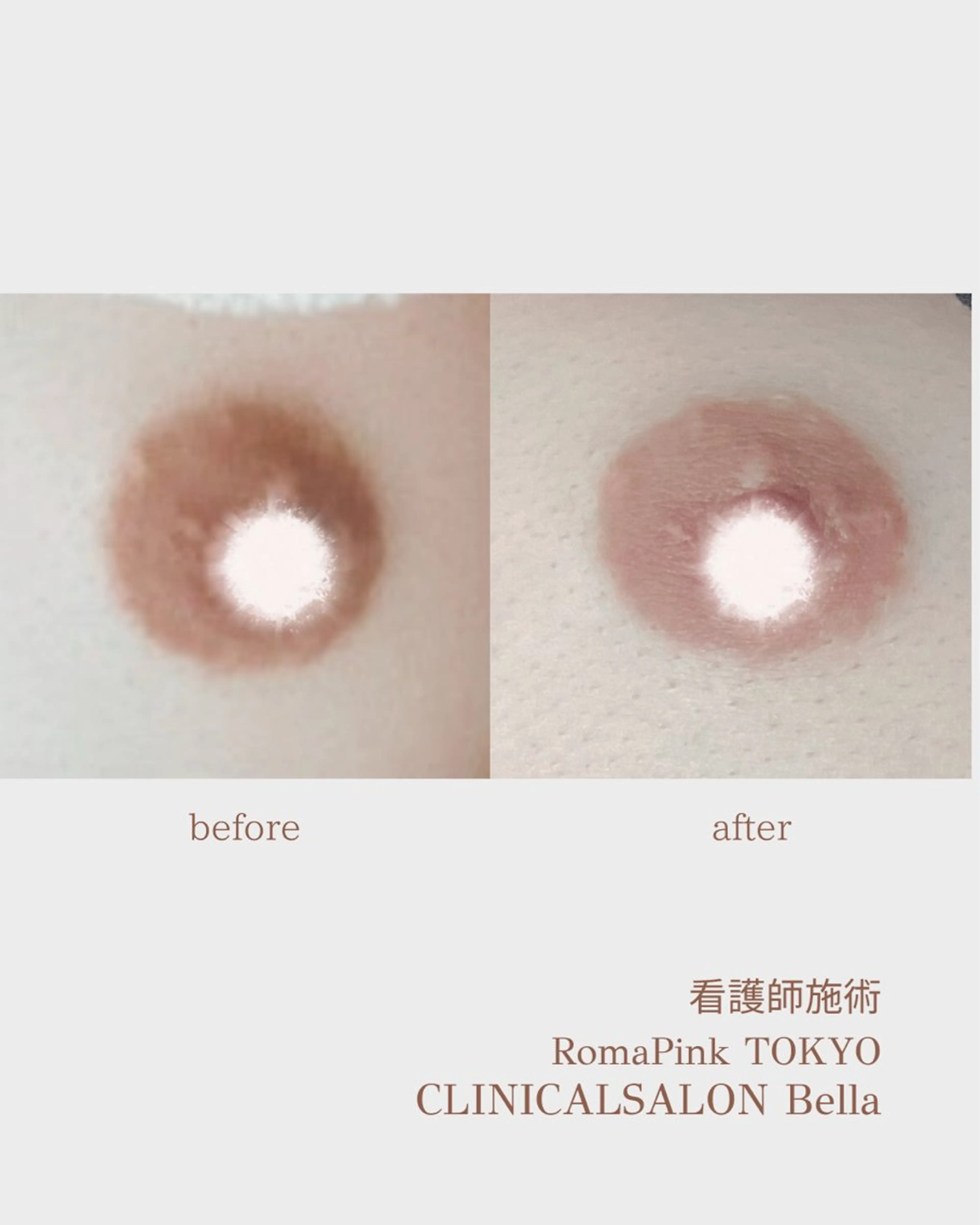 看護師 AYUIのエステ・リラクイメージ