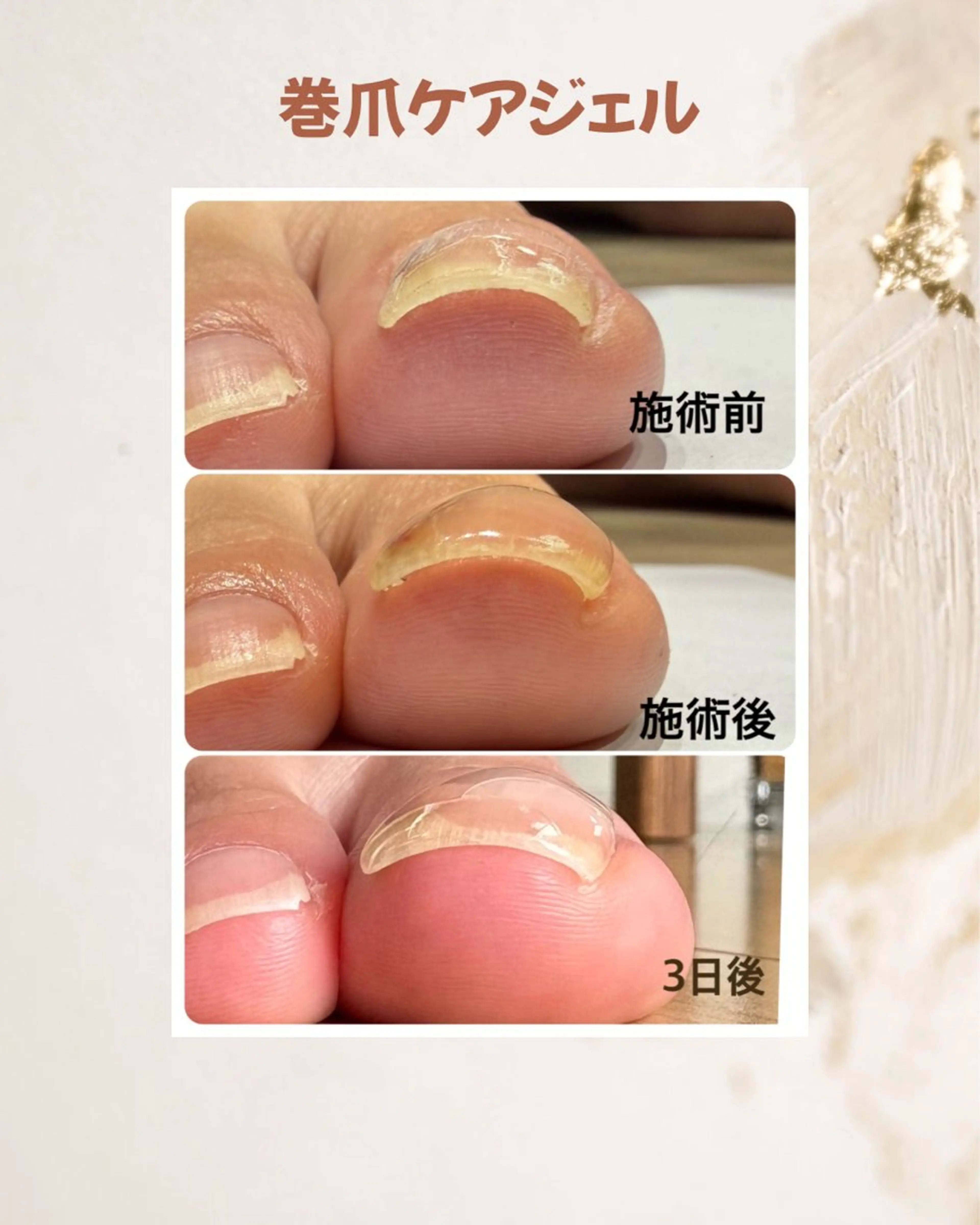 ネイル ジェルネイル フットネイル Aubel.nord_nail所属・Aubel.nord オーベルノールのネイルデザイン