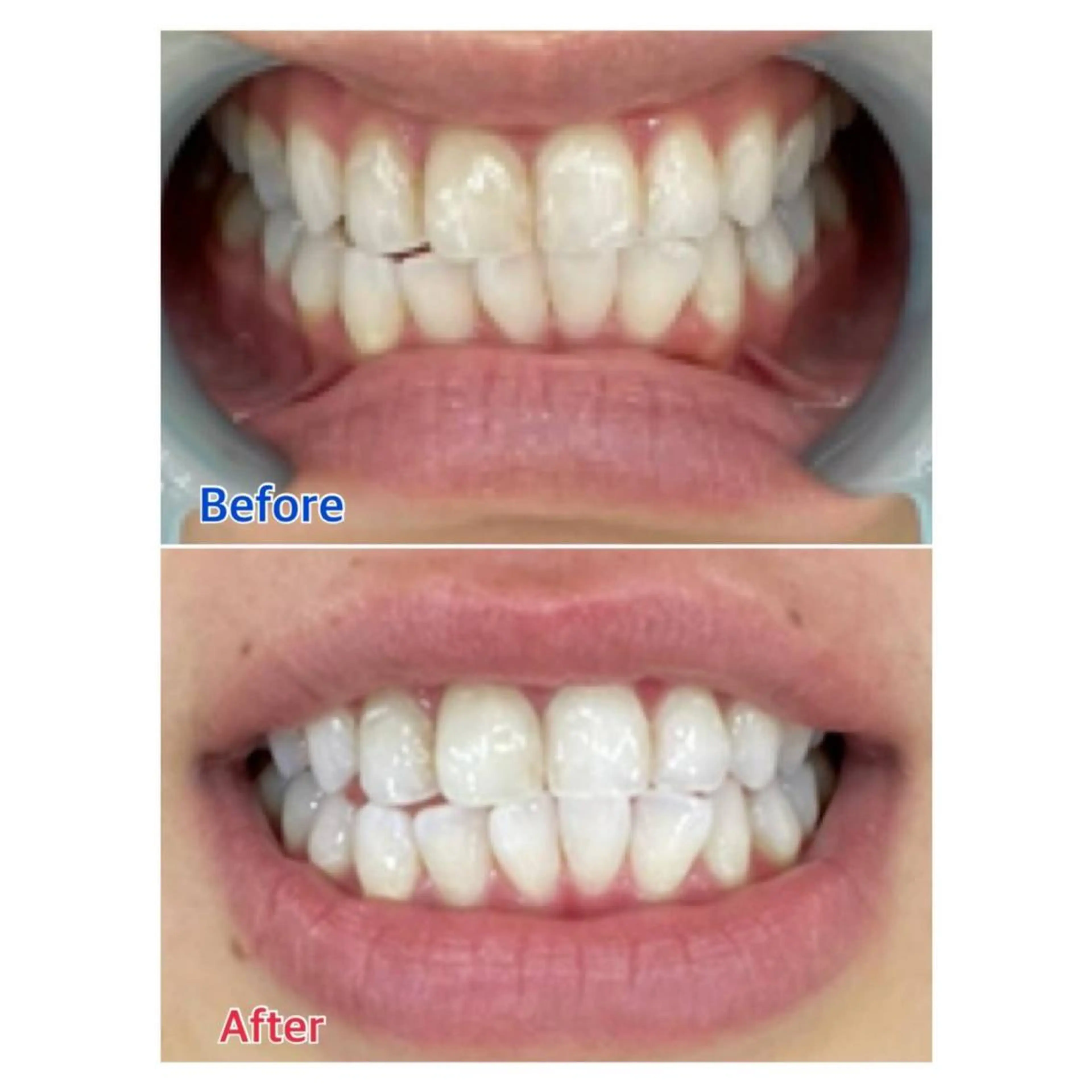 MBEAUTYSALON 千葉店・京成大久保所属・Melty 輝のその他イメージ