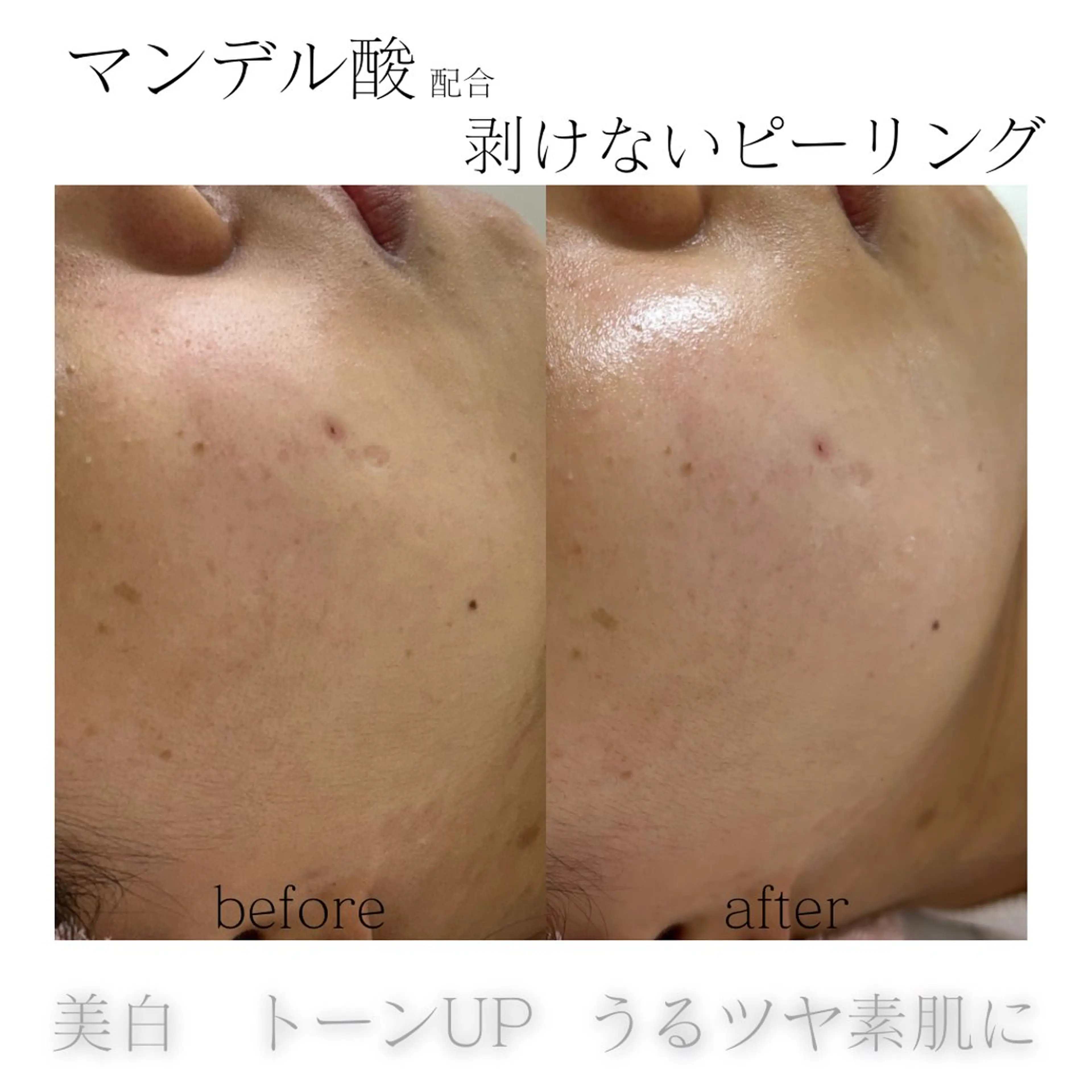 メンズ エステ 歌舞伎町深夜サロン to mëのエステ・リラクイメージ