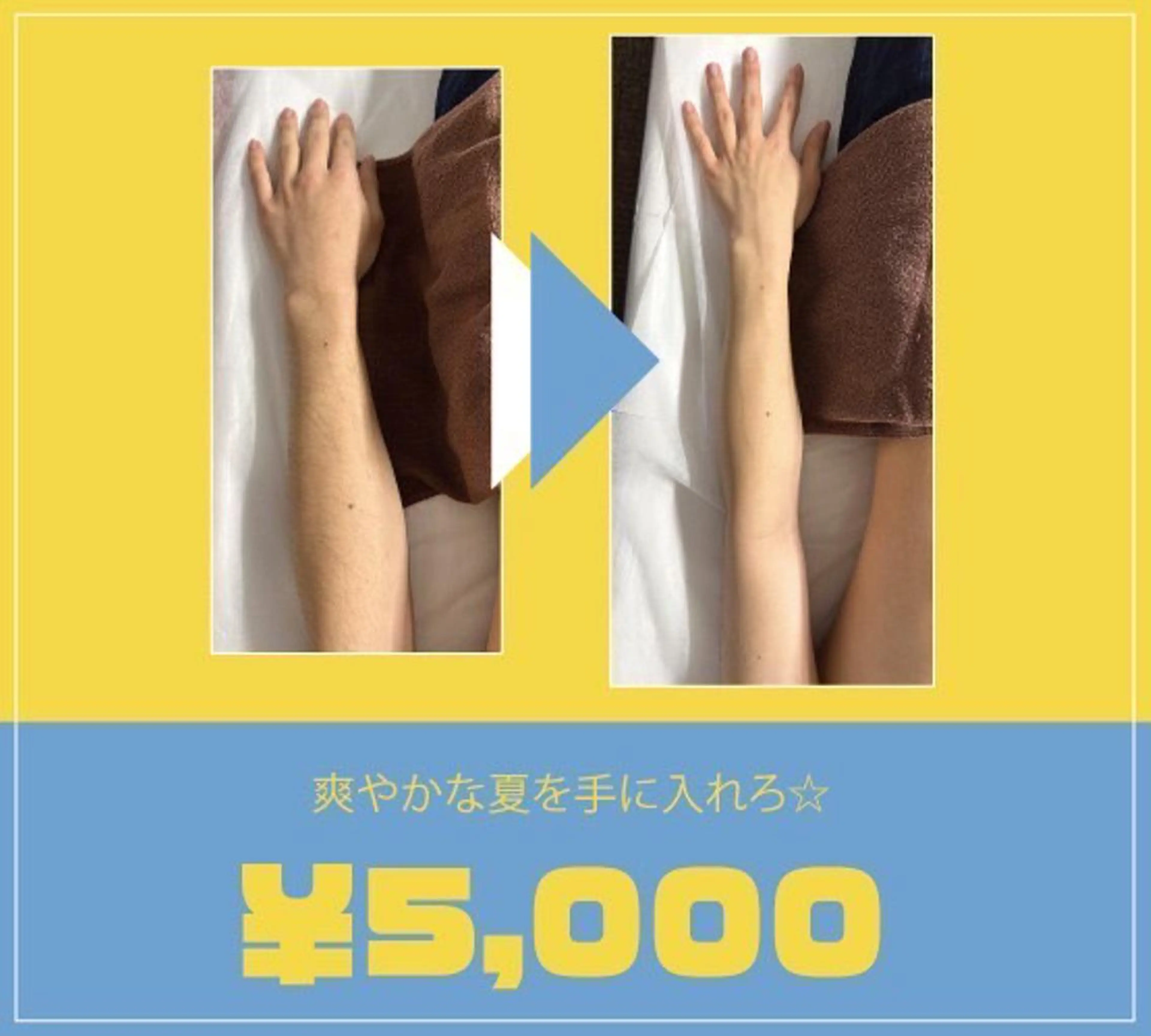 【清潔感あるツル肌】メンズ　ヒジ下セットの写真