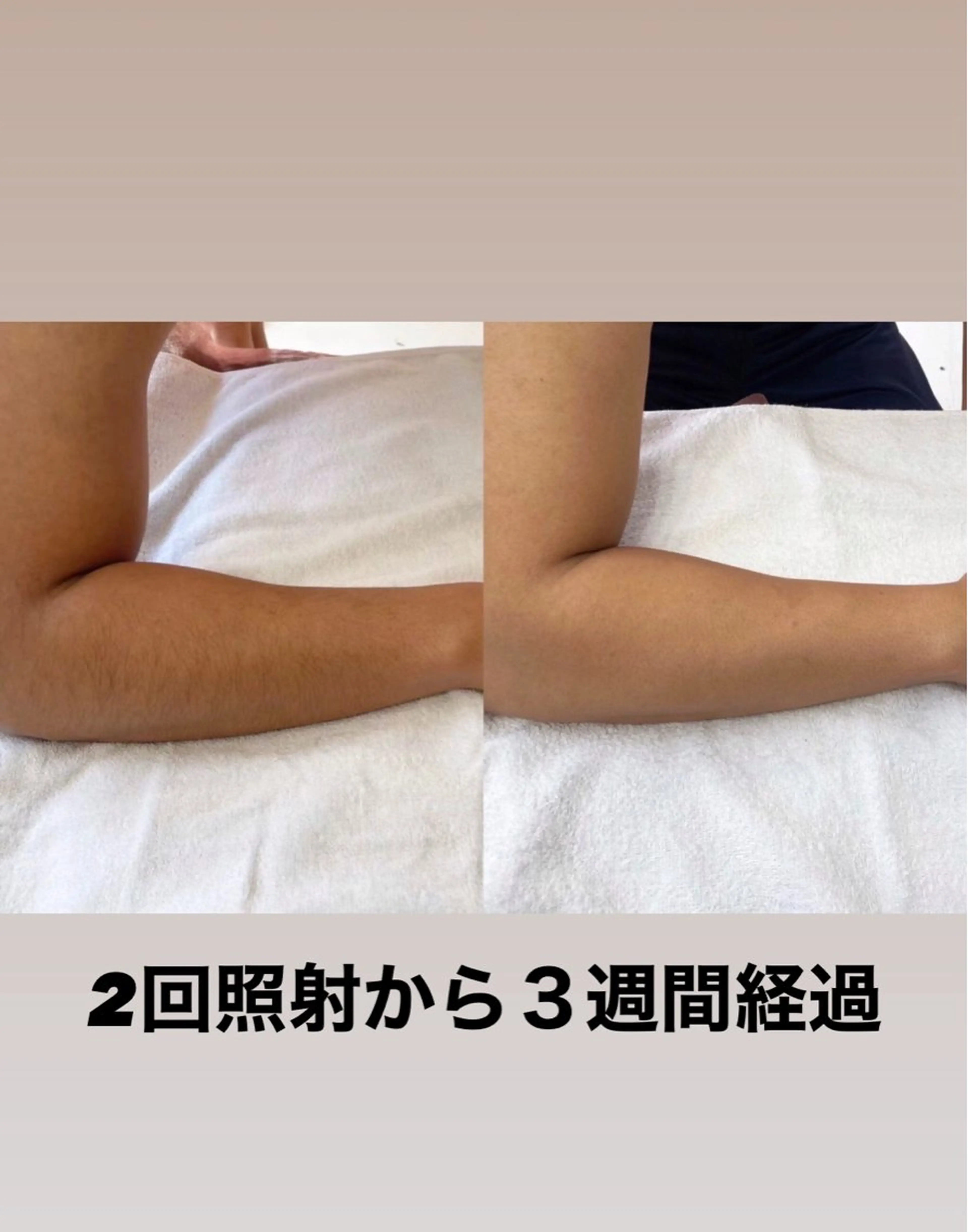 グレイスフルルーム所属・【本格脱毛】 グレイスフルルームのエステ・リラクイメージ