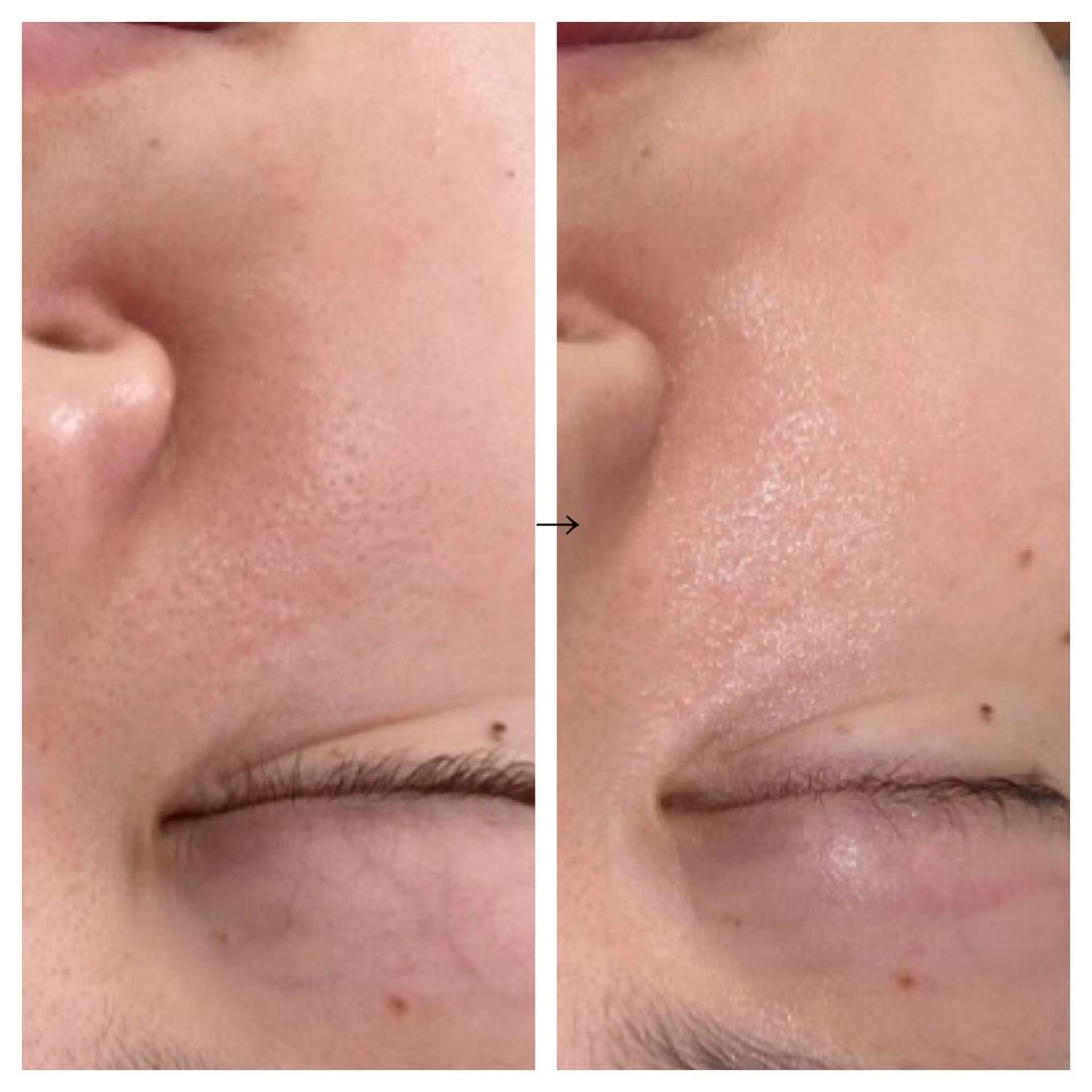 ビューティー ミロワールのエステ・リラクイメージ