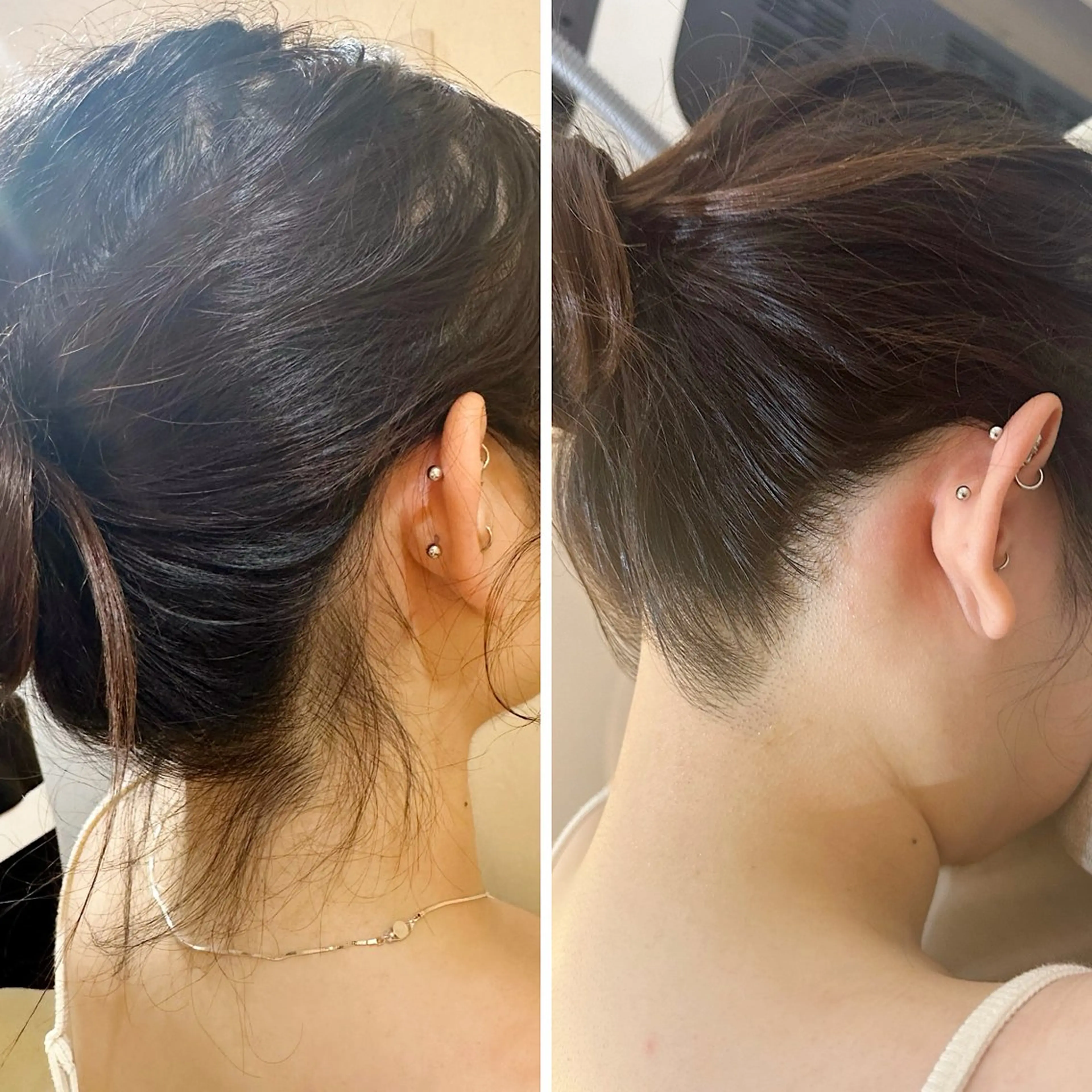 脱毛 うなじ脱毛/美肌脱毛 LABELのエステ・リラクイメージ