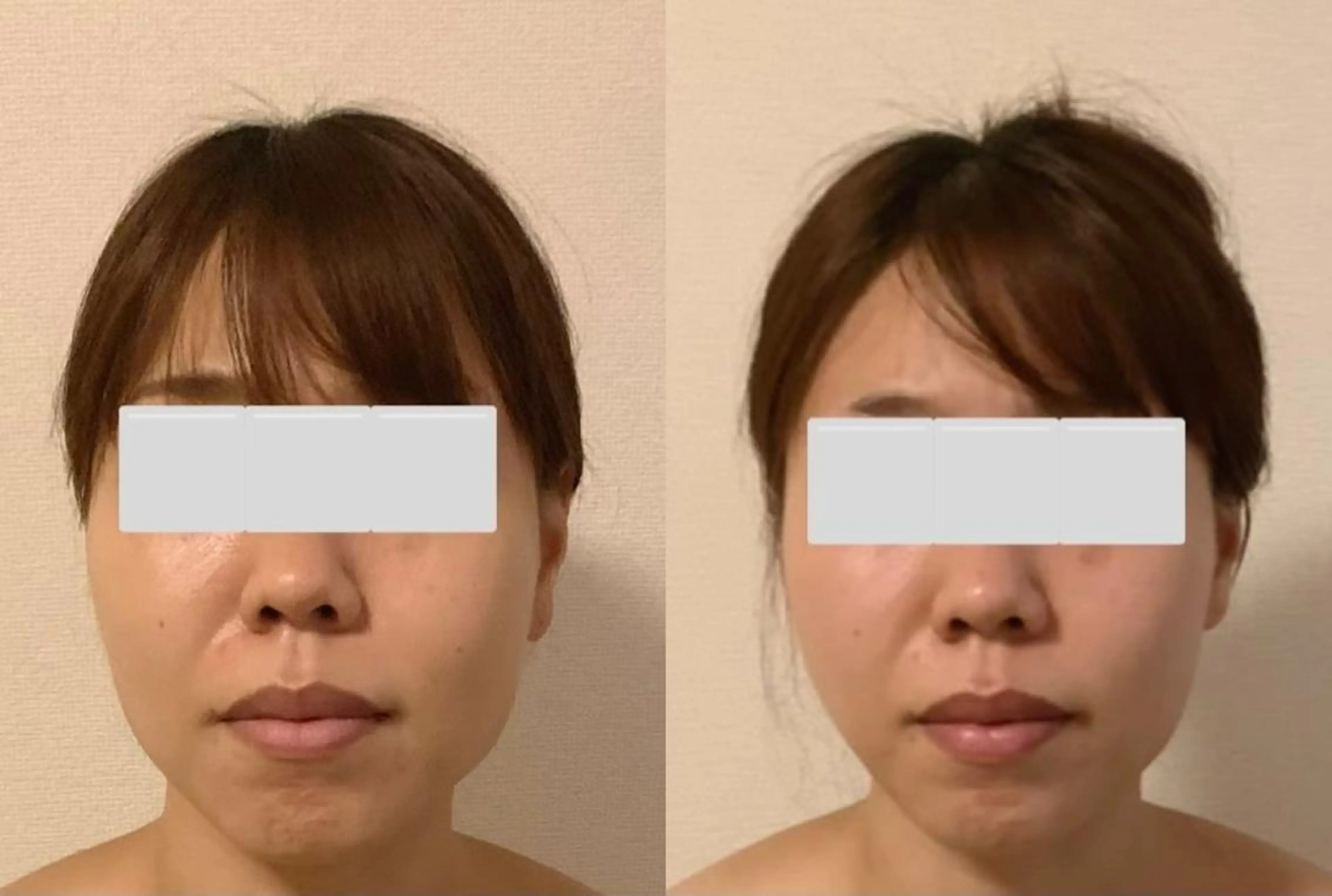 a  room salonのエステ・リラクイメージ