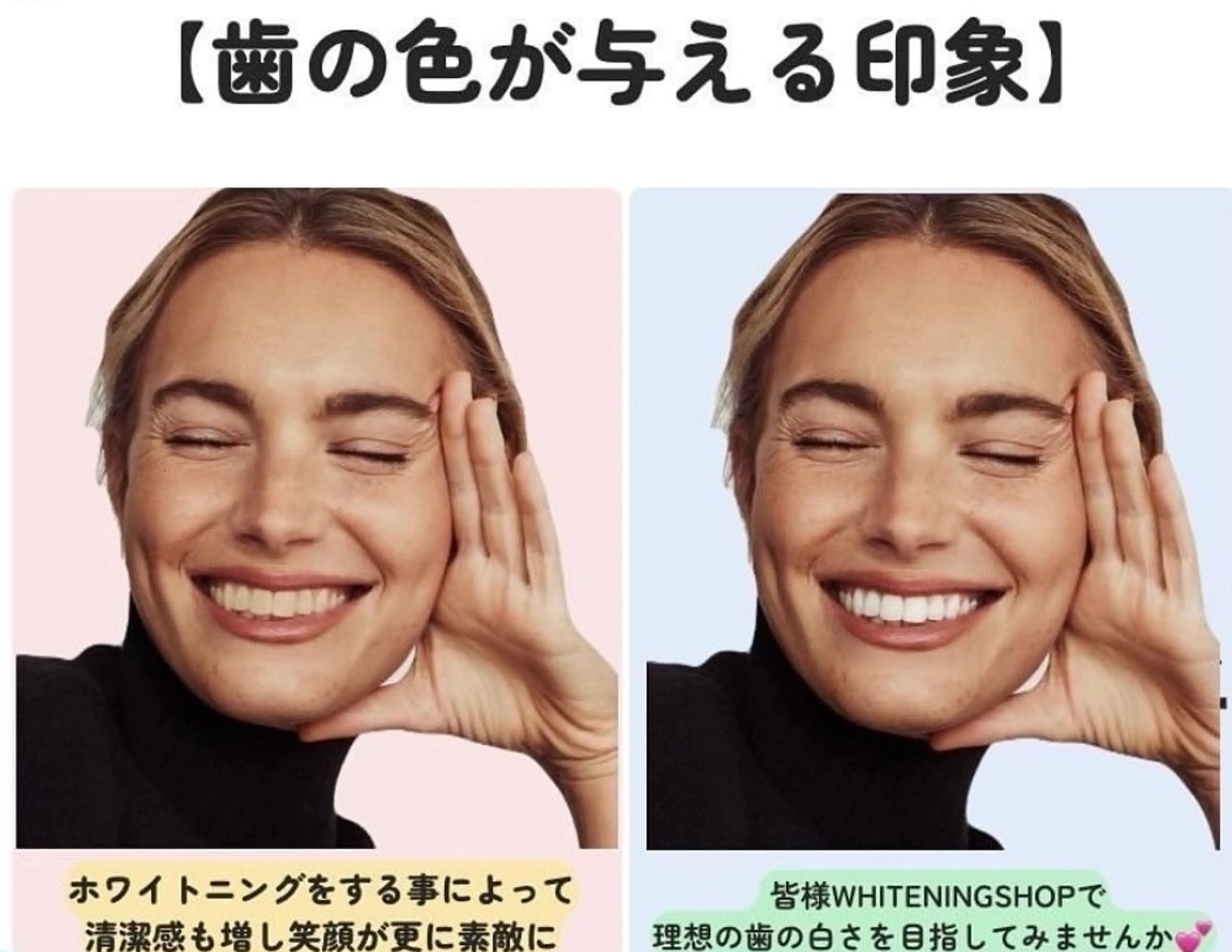 ホワイトニングショップ伊丹店所属・ホワイトニング ショップ伊丹店のその他イメージ