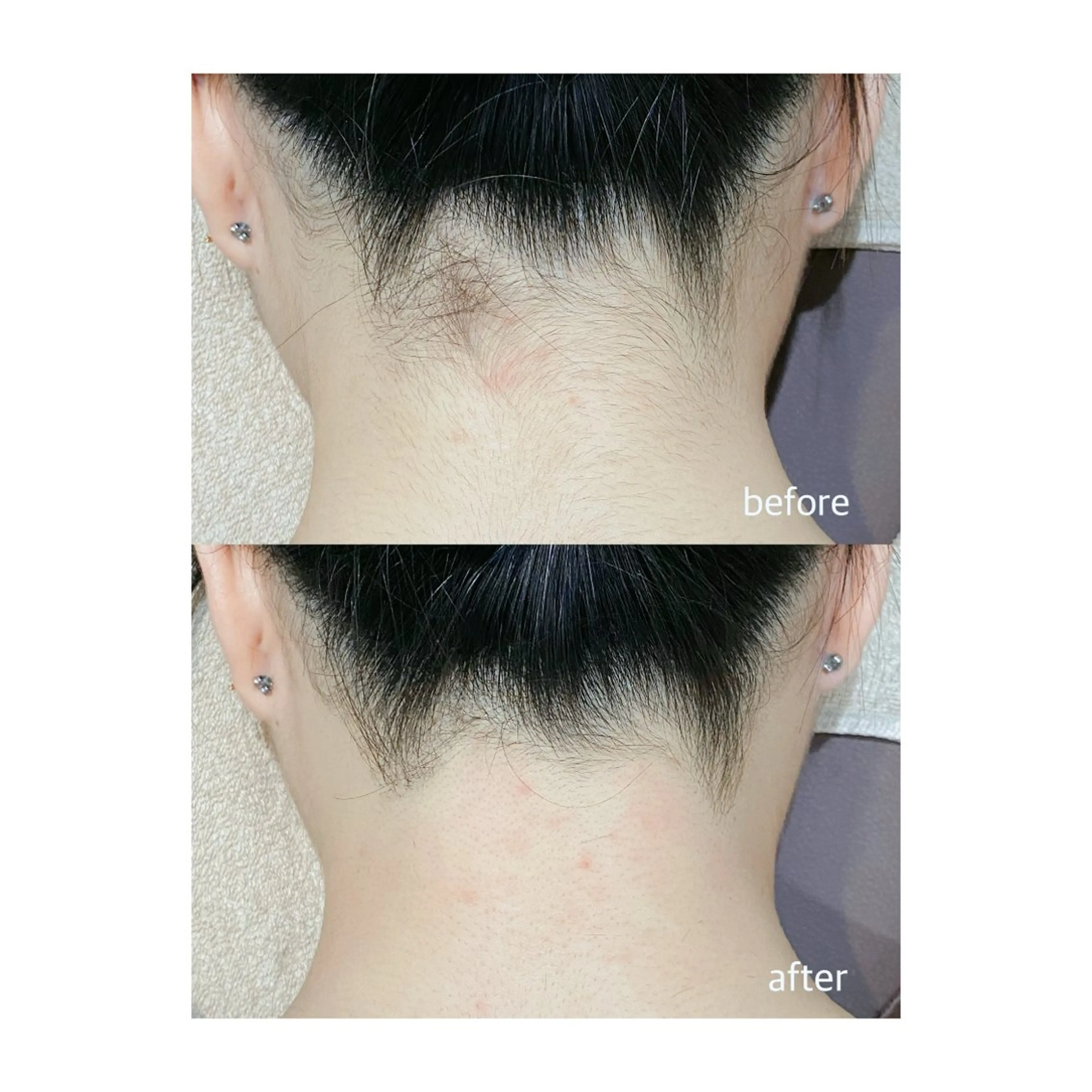 脱毛 M's Style NAIL BARのエステ・リラクイメージ