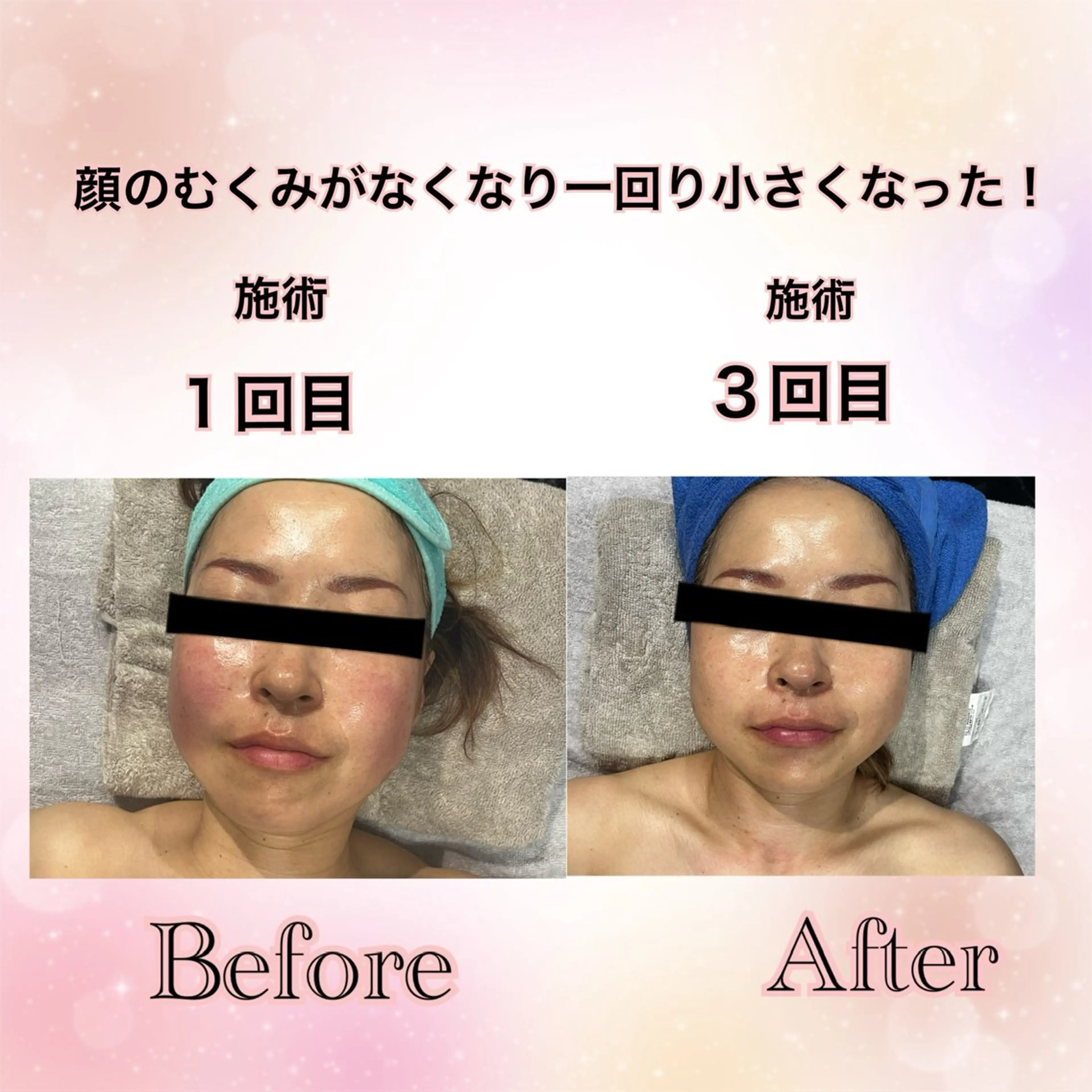 Total Beauty  ラトゥール所属・ラトゥール Maiのエステ・リラクイメージ