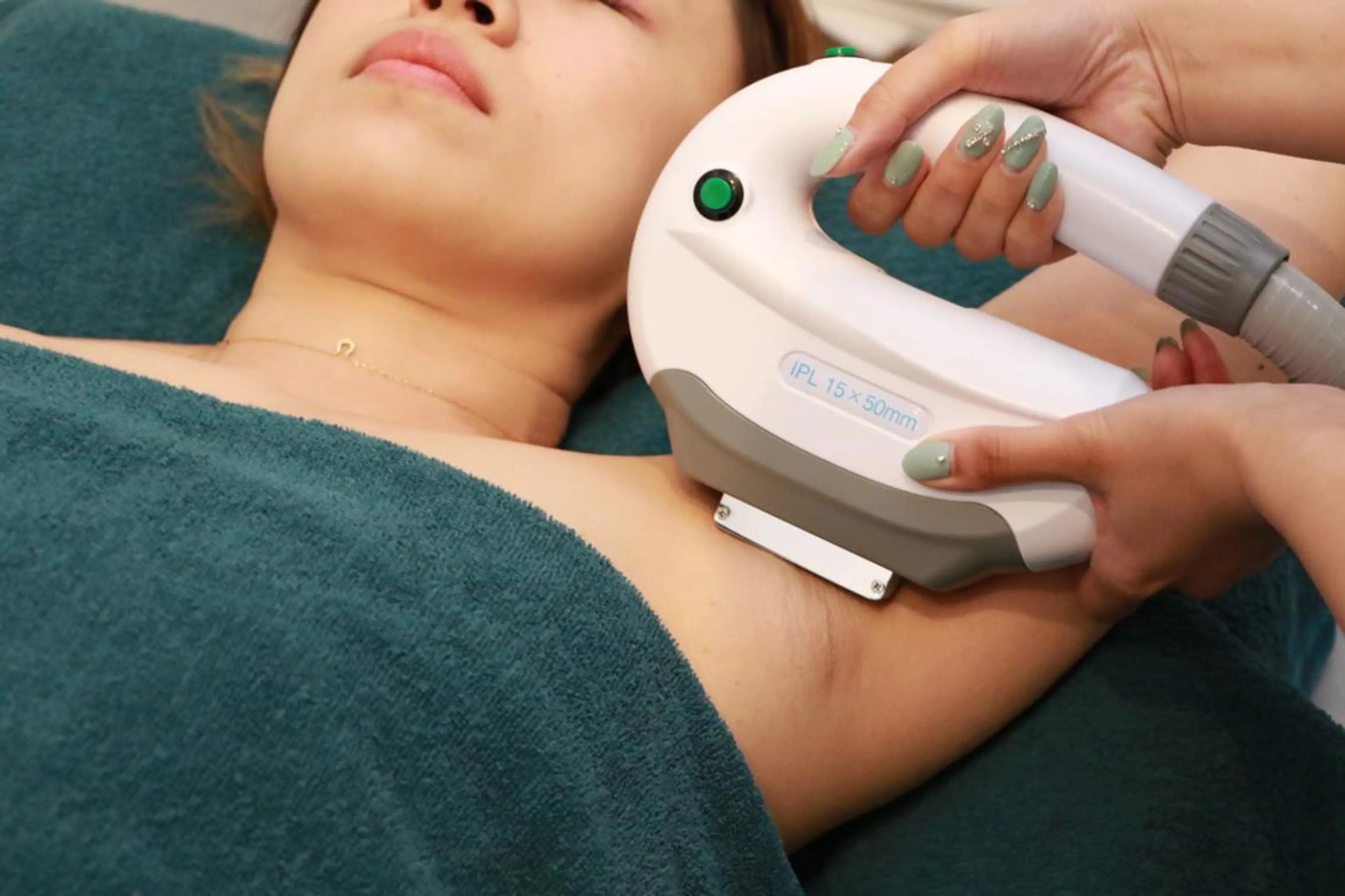 脱毛　SHR、IPLマグライト両ワキ脱毛１回¥2200の写真