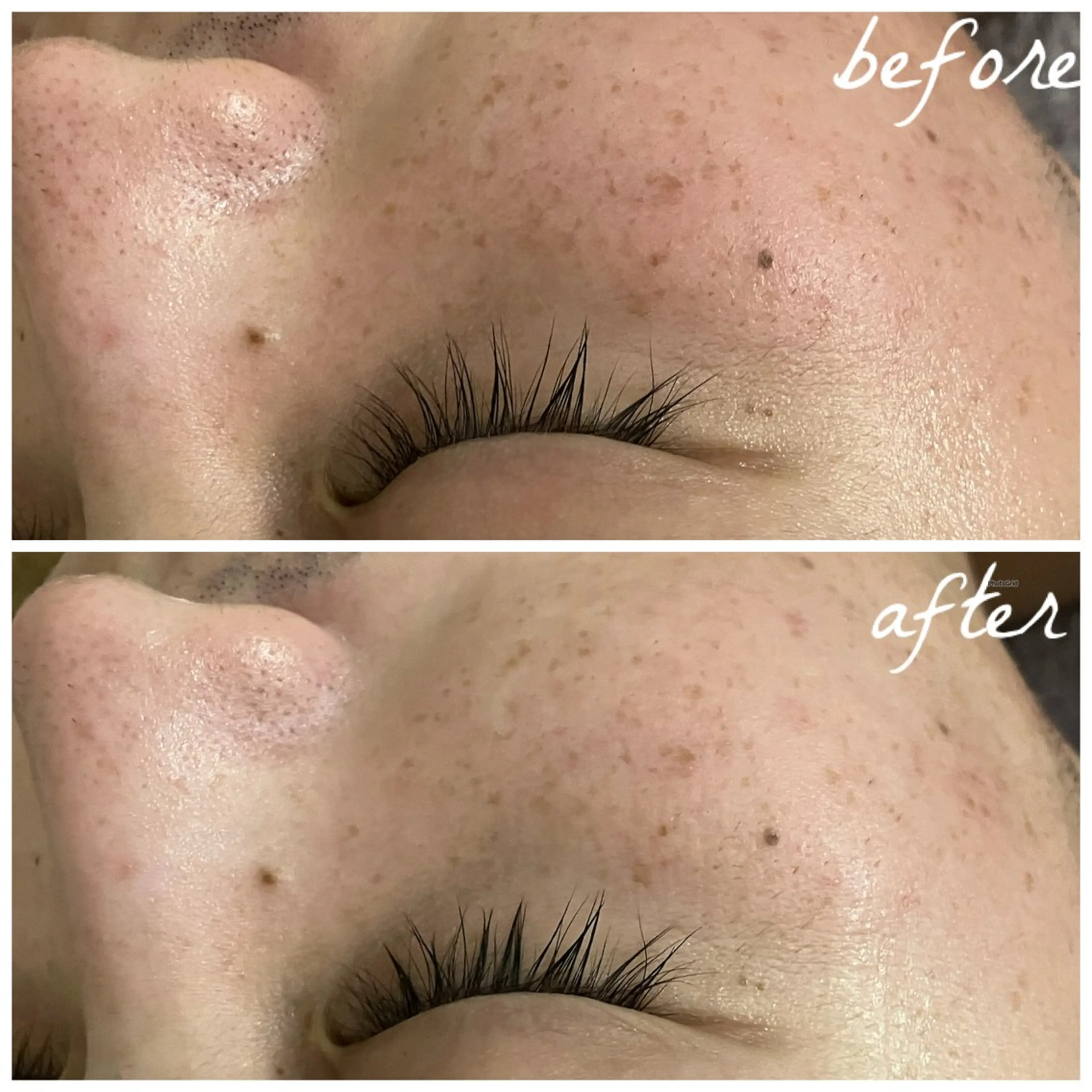 メンズ エステ メナード岐阜茜部 杉浦のエステ・リラクイメージ