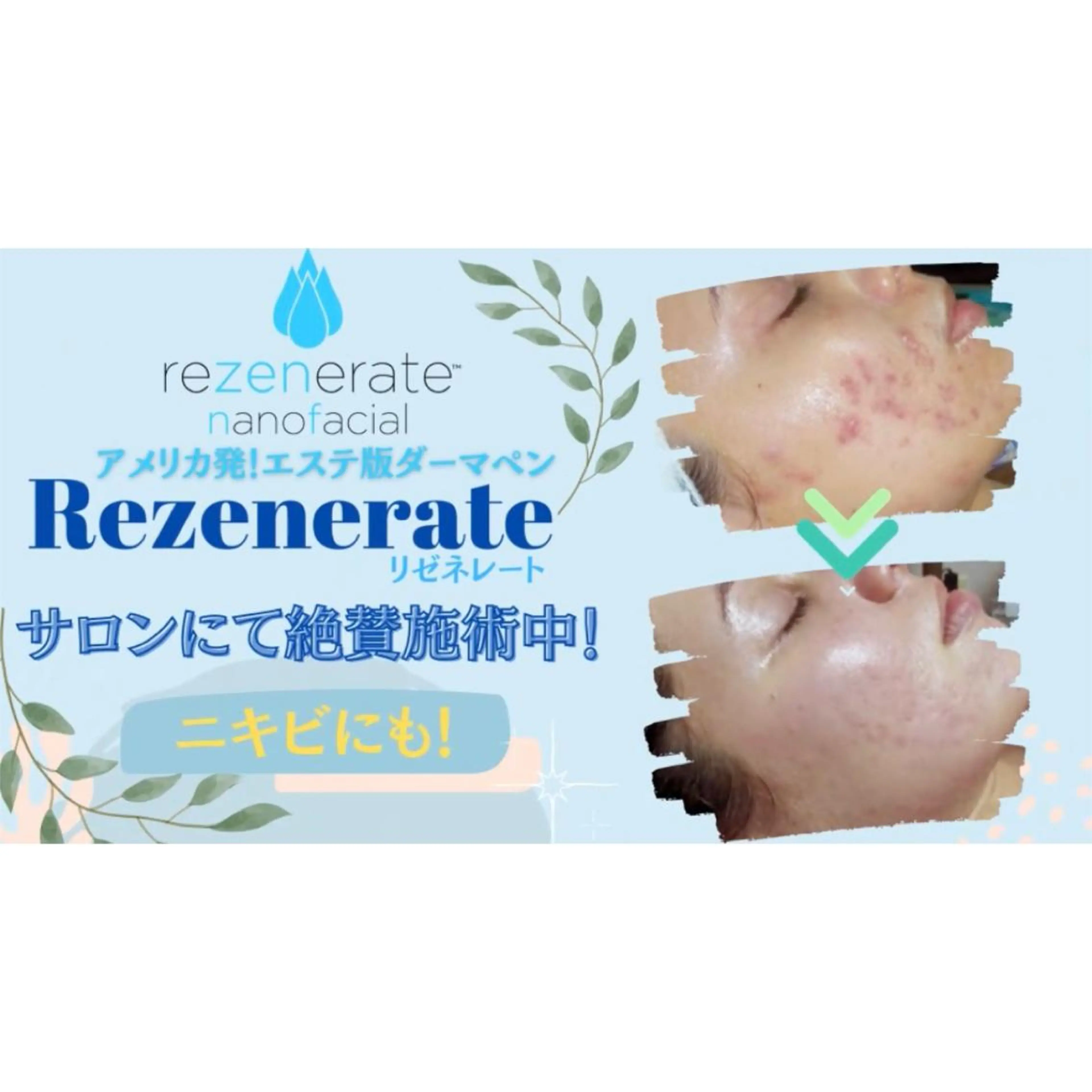 エステ Ailes de Ange　MARIのエステ・リラクイメージ