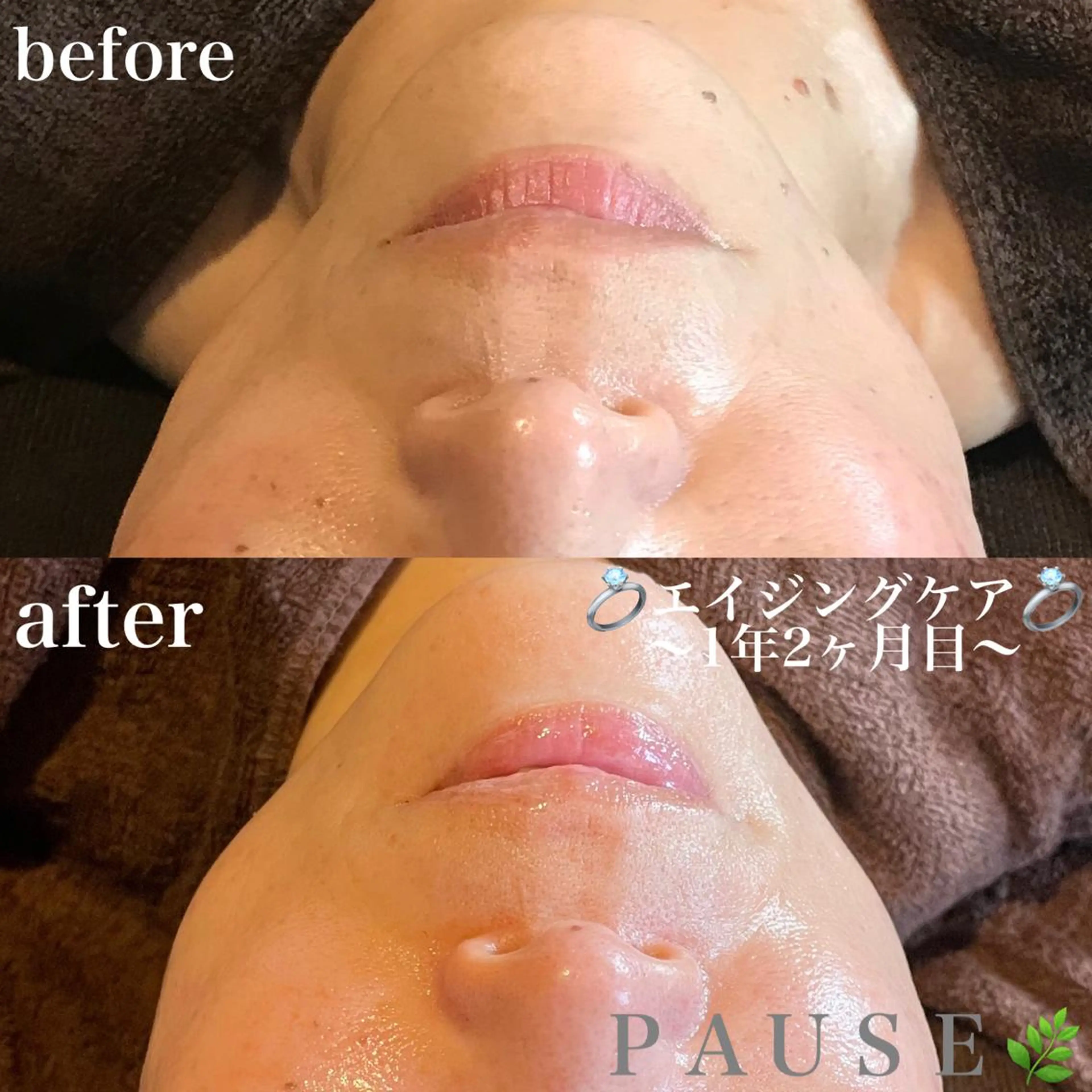 エステ 浜野 恵美のエステ・リラクイメージ