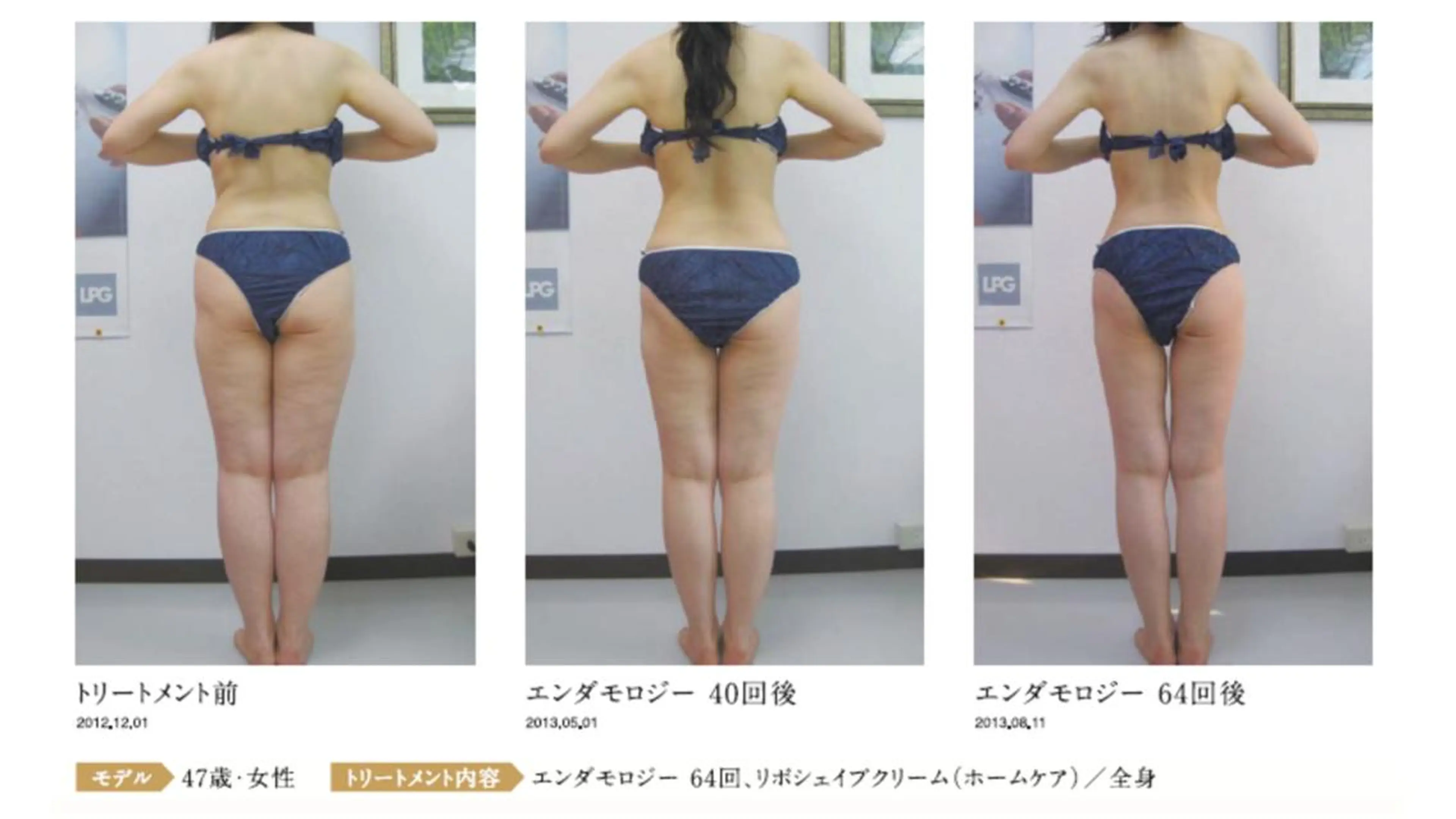 オレンジバナナ 県央店のエステ・リラクイメージ