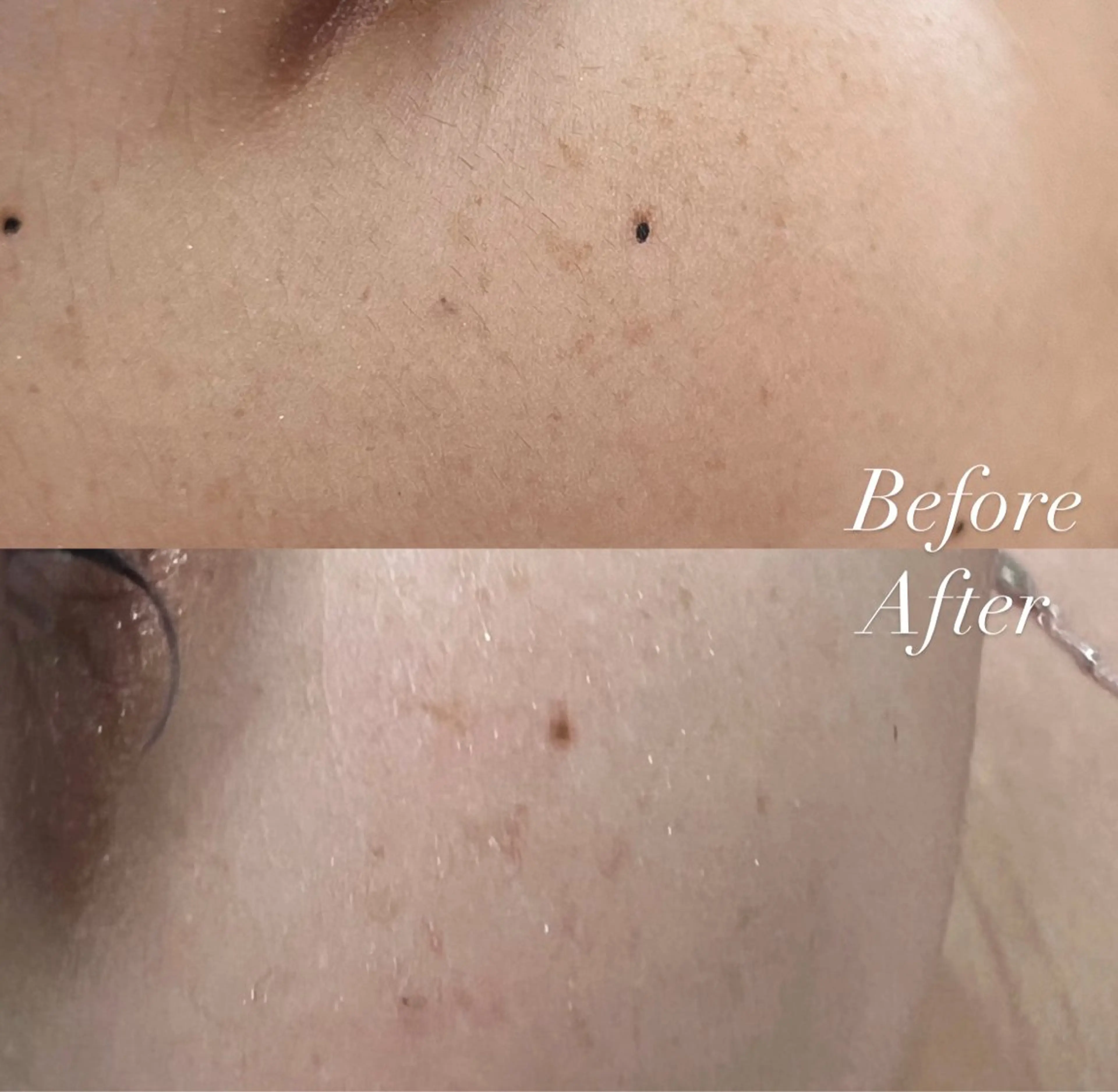 Cheri所属・丸山 彩乃のエステ・リラクイメージ