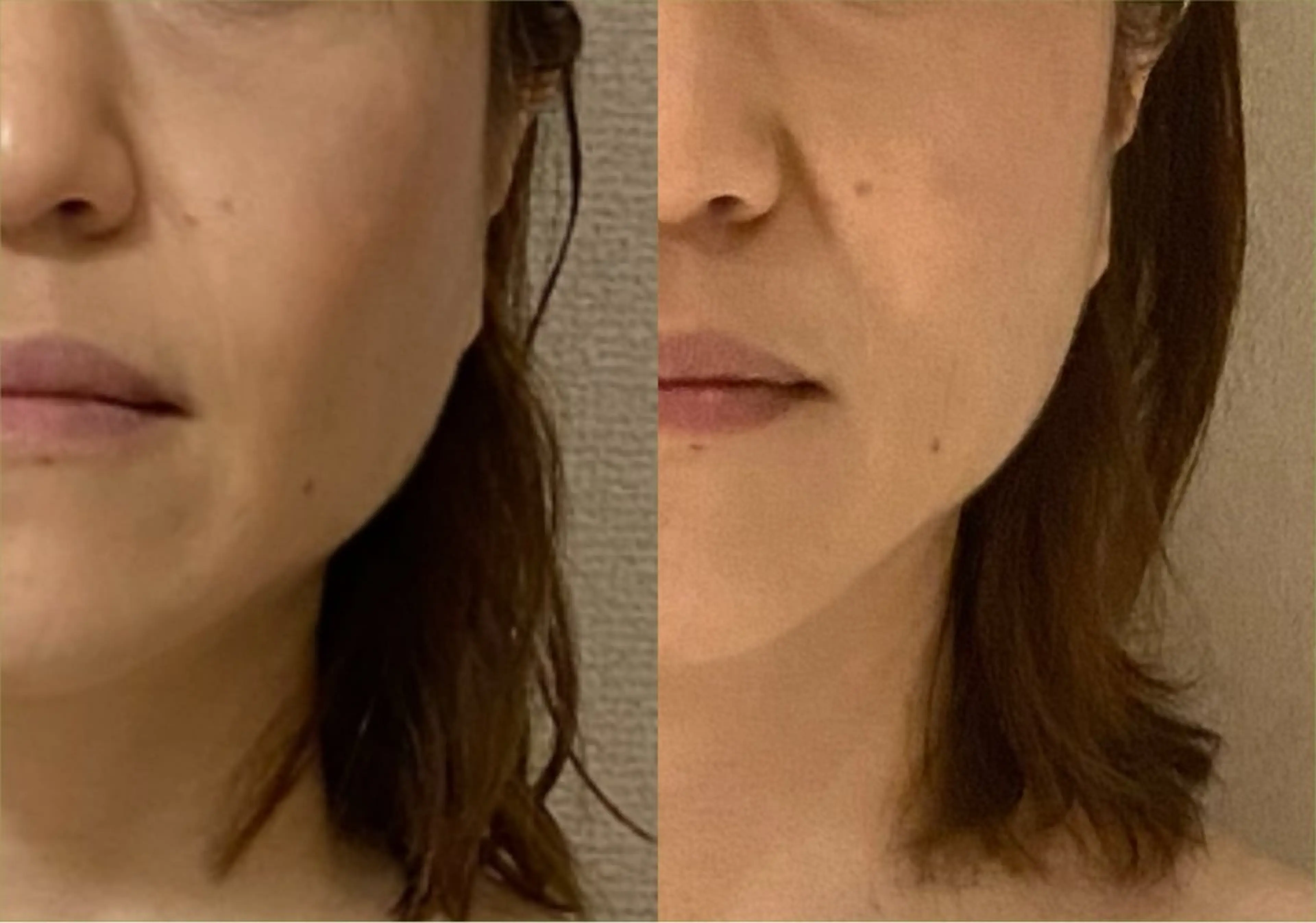 private salon.ohana所属・小顔/ララピール ohanaのエステ・リラクイメージ