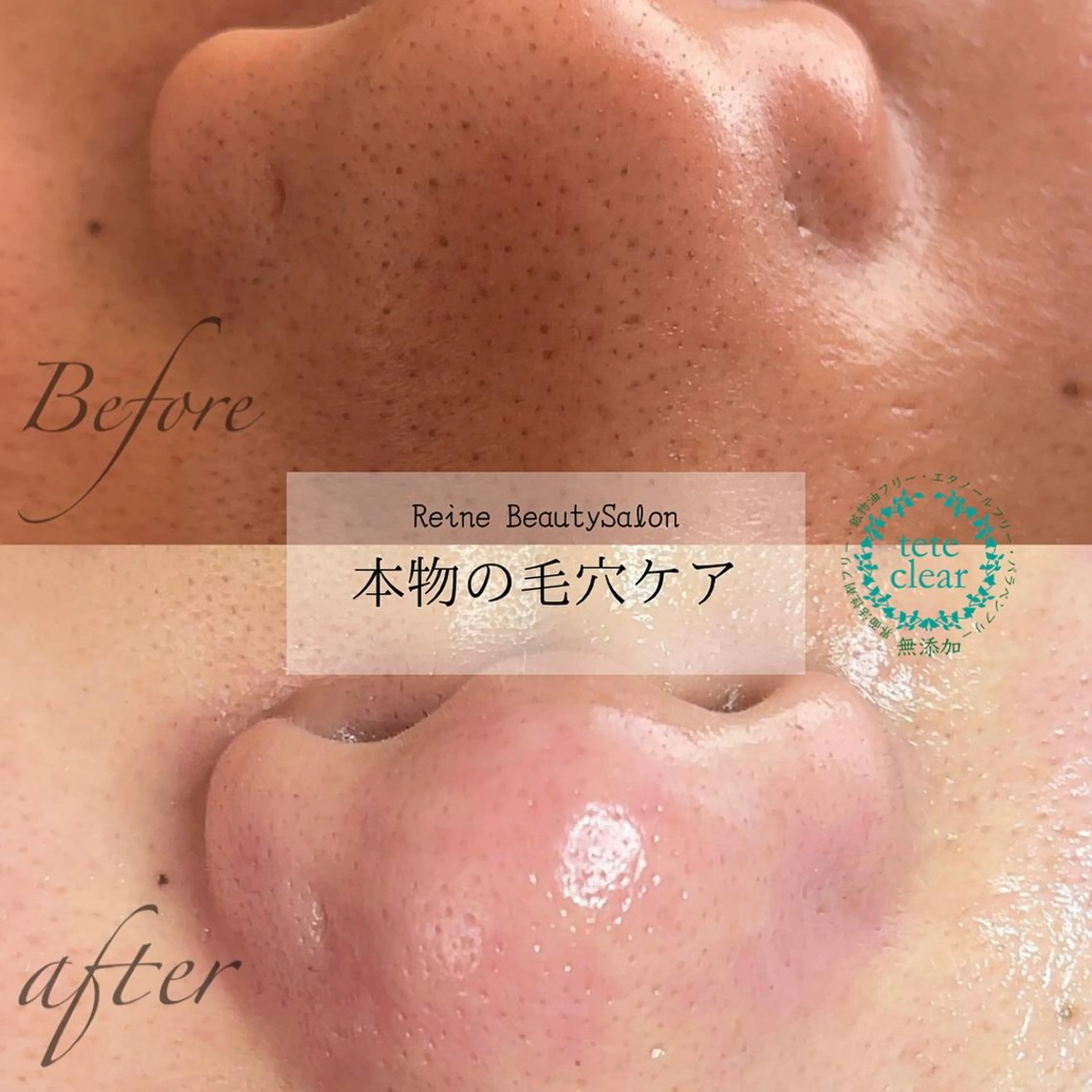 エステ Reine BeautySalon所属・毛穴/シミ肝斑/脱毛 横山梨里のエステ・リラクイメージ