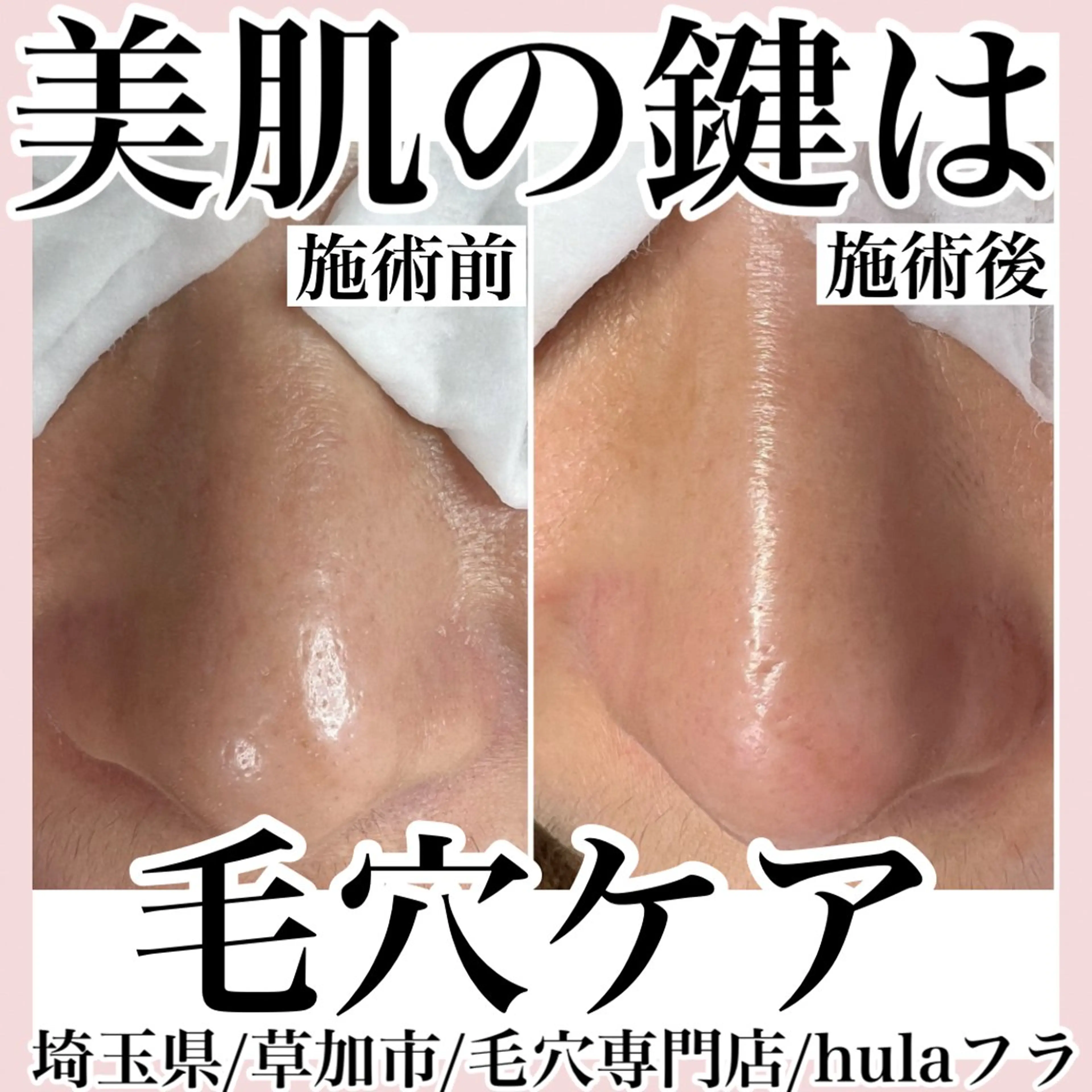 エステ 毛穴専門店hula 杉山智美のエステ・リラクイメージ