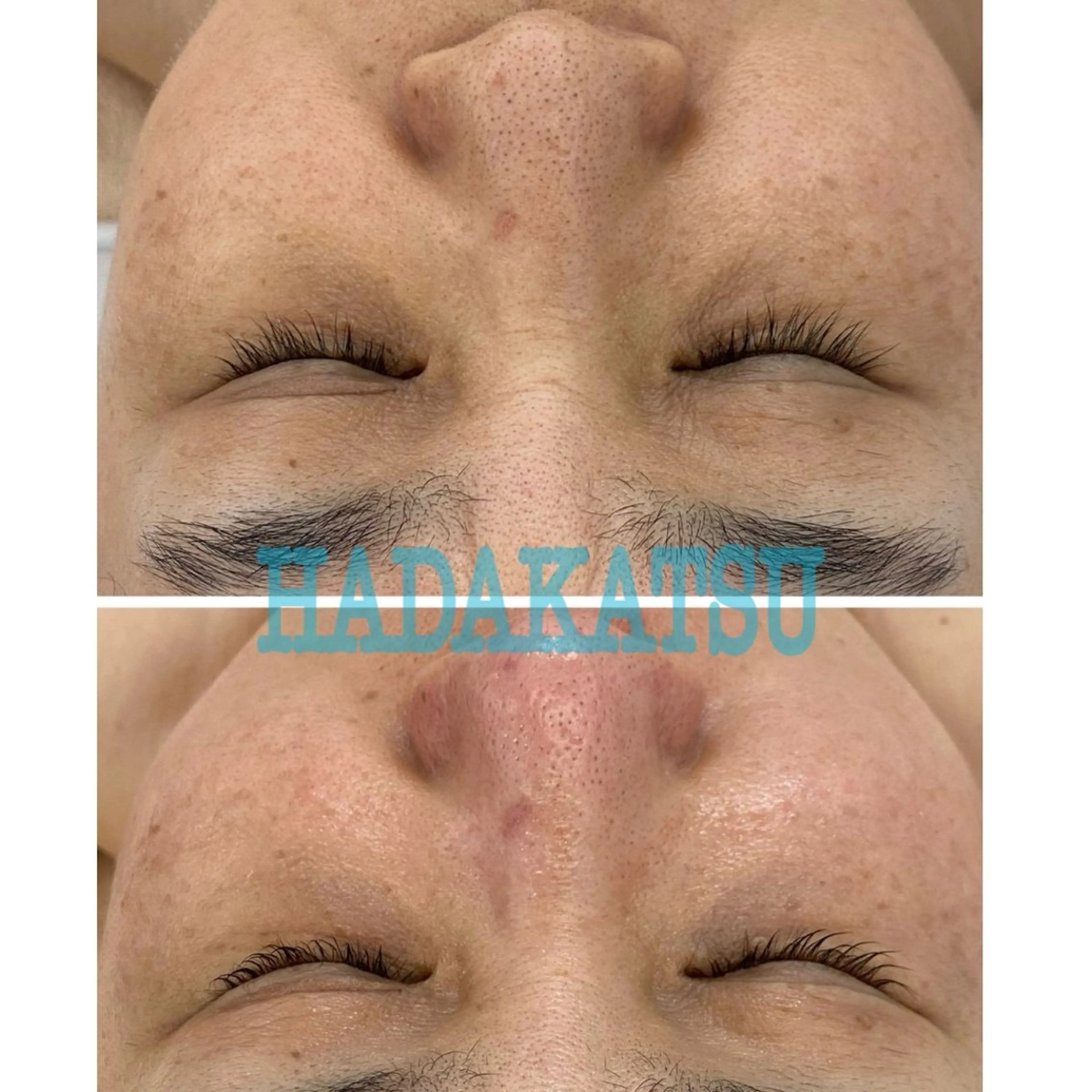 【期間限定】眼精疲労・目元クマ・シワ・たるみ集中ケア(極上デコルテマッサージ付)の写真