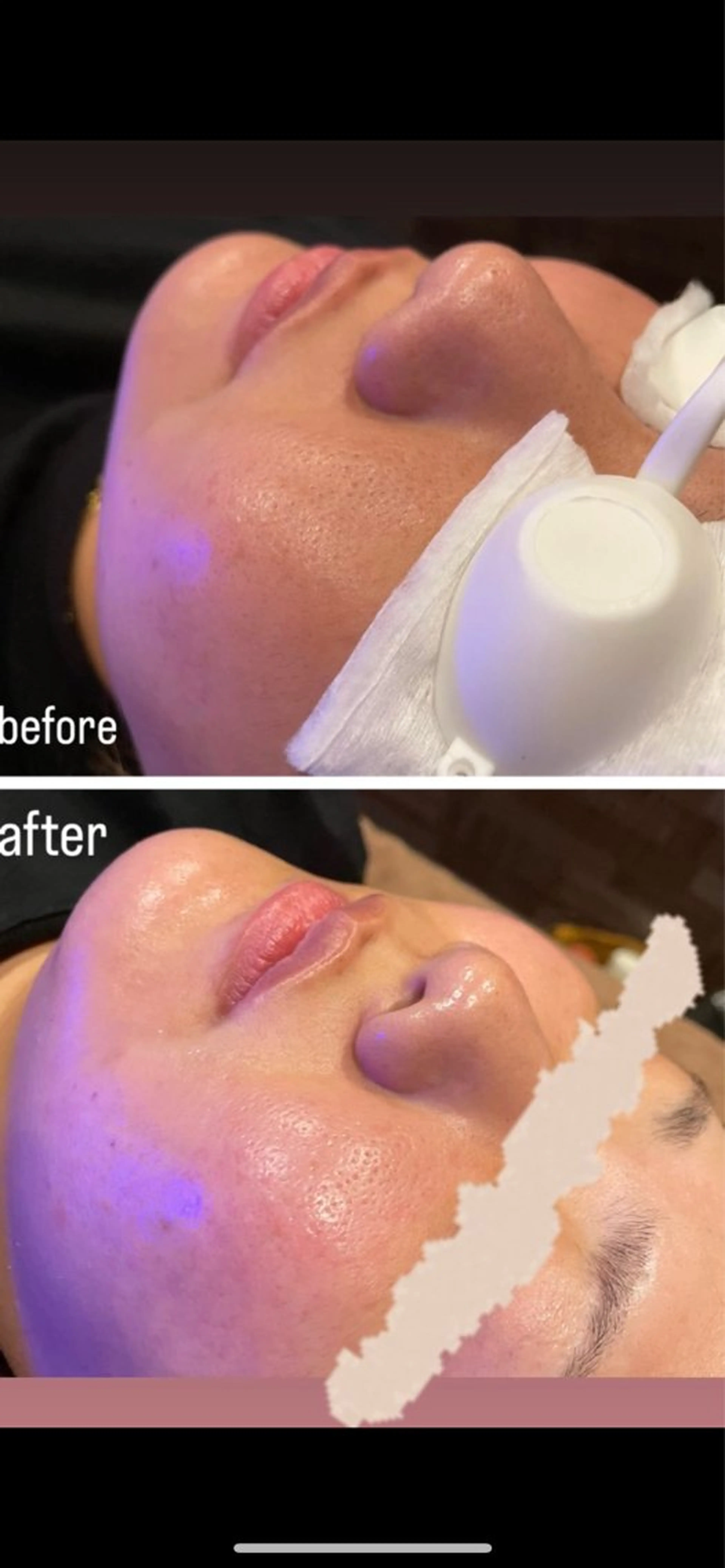 エステ Salon  LUMINA所属・真栄平 美咲のエステ・リラクイメージ